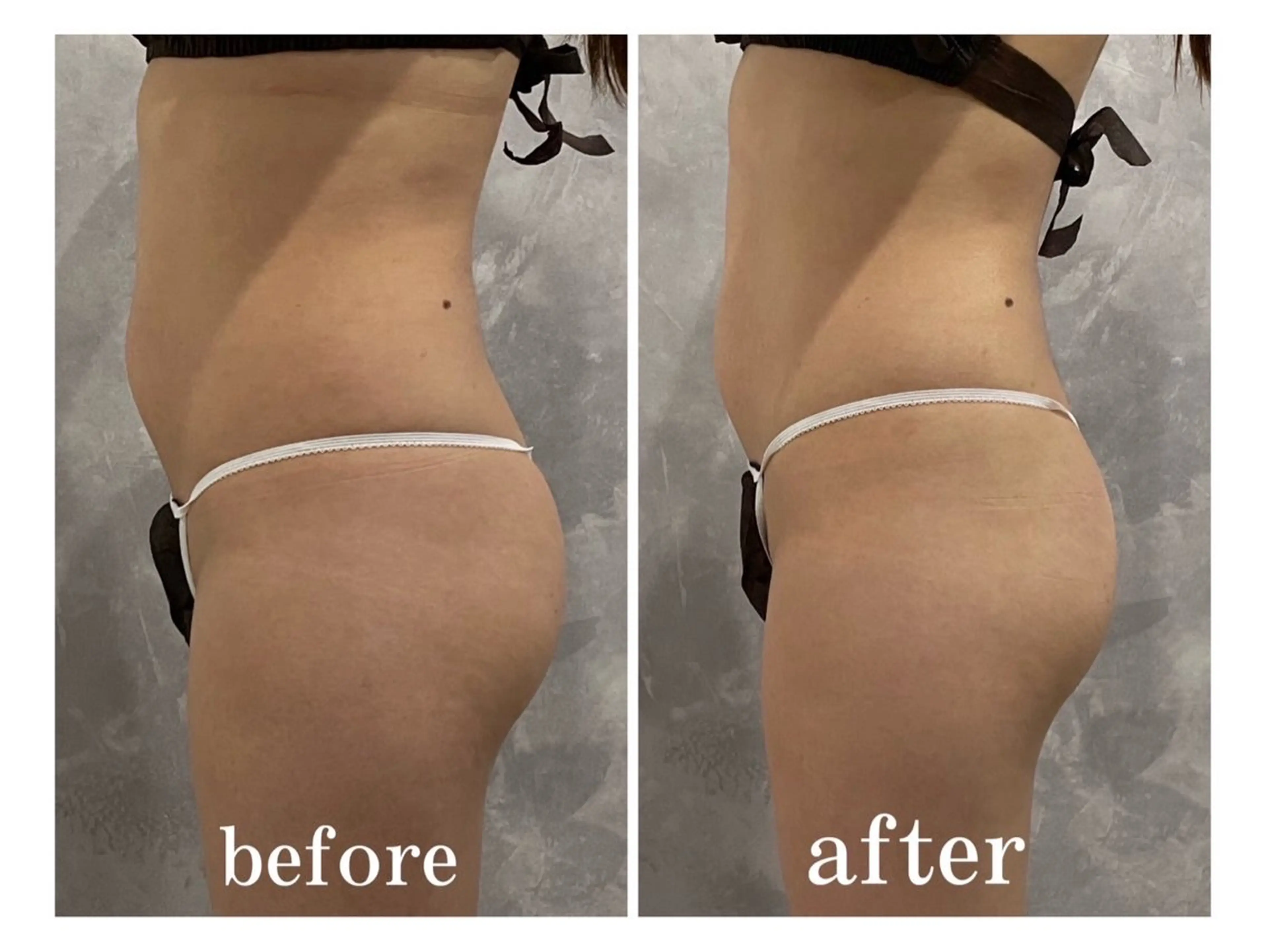 【新規女性/年齢を重ねた“痩せにくい“に】筋膜リリース全身痩身90分¥9900の写真