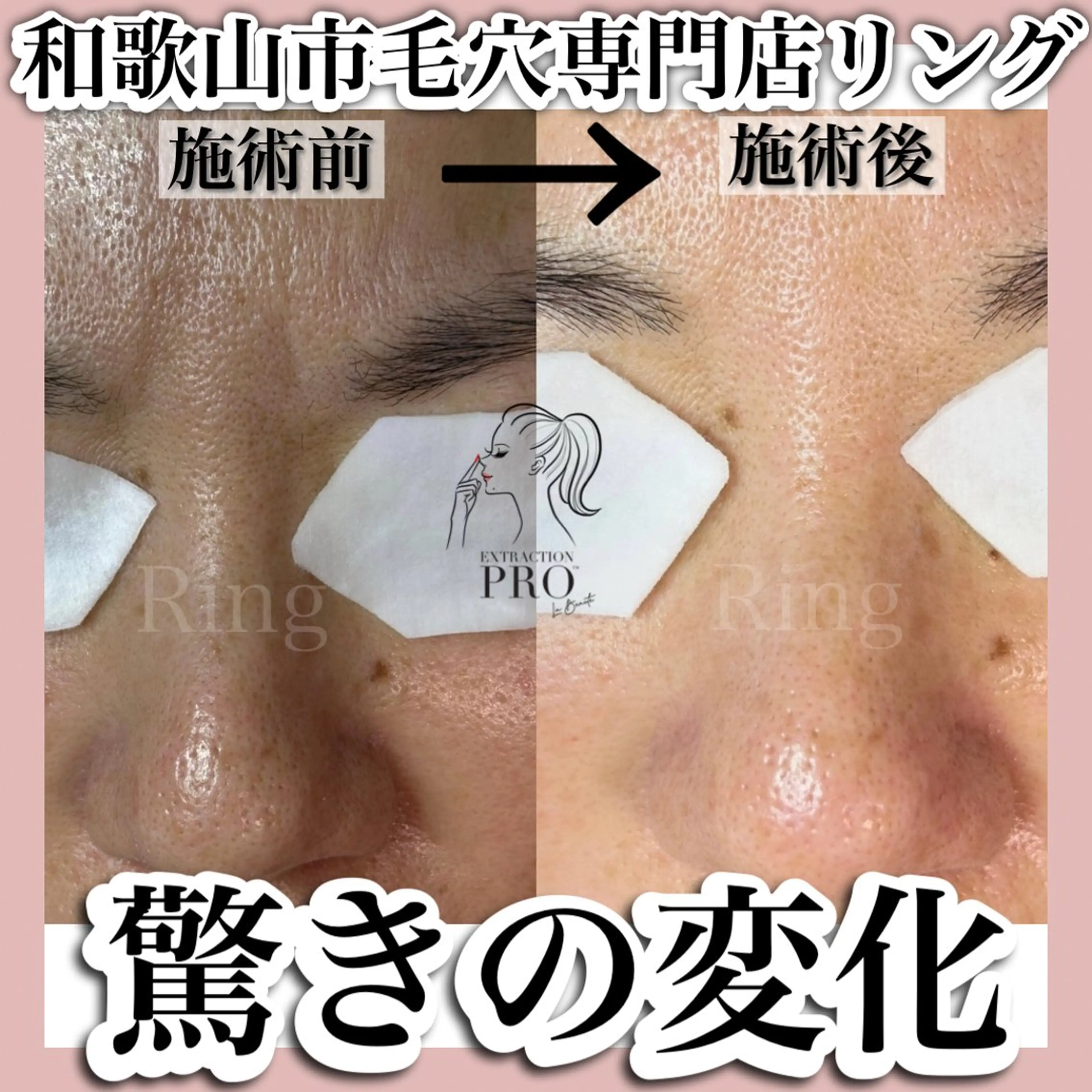 和歌山　毛穴専門店 Ringのエステ・リラクイメージ