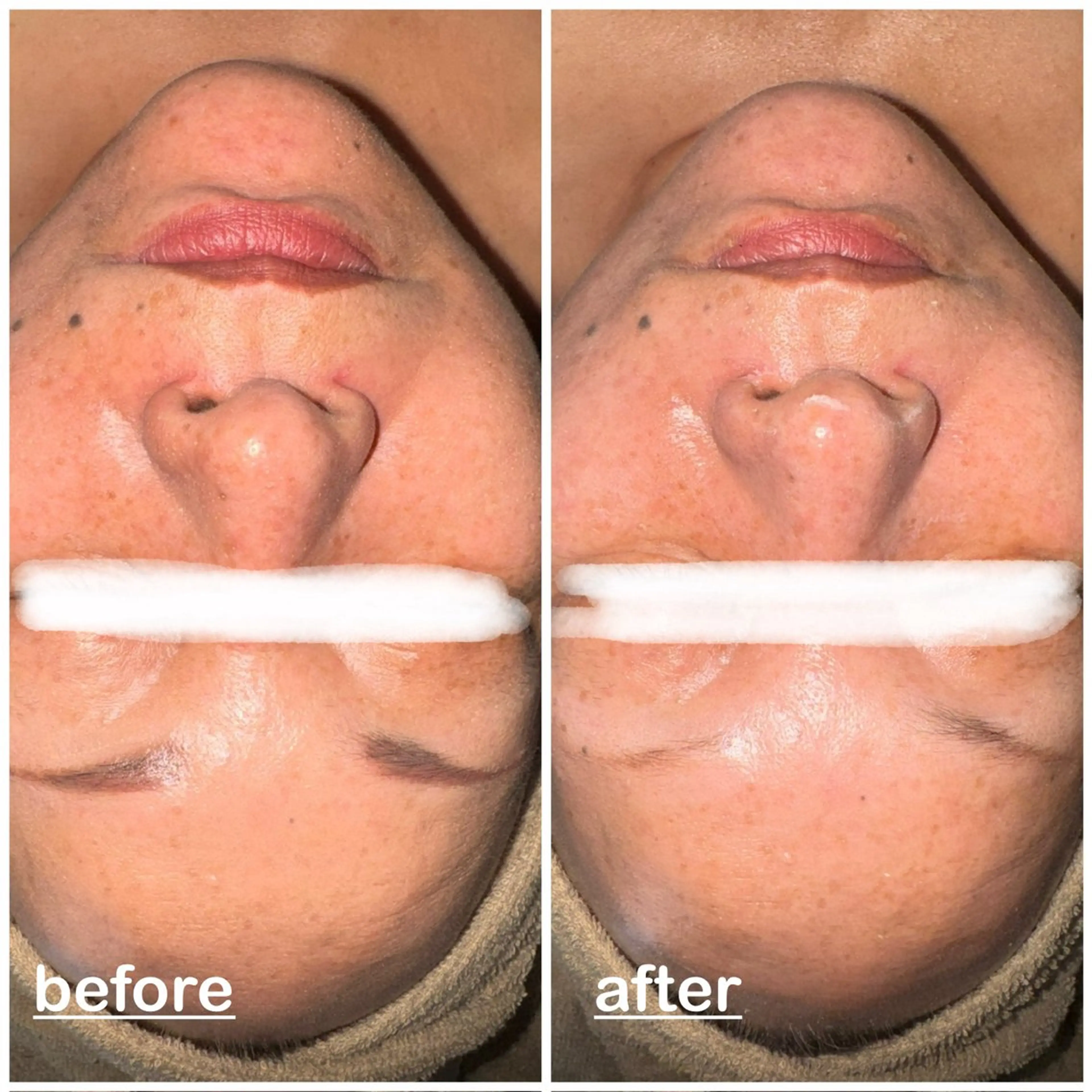 mignon miyuのエステ・リラクイメージ