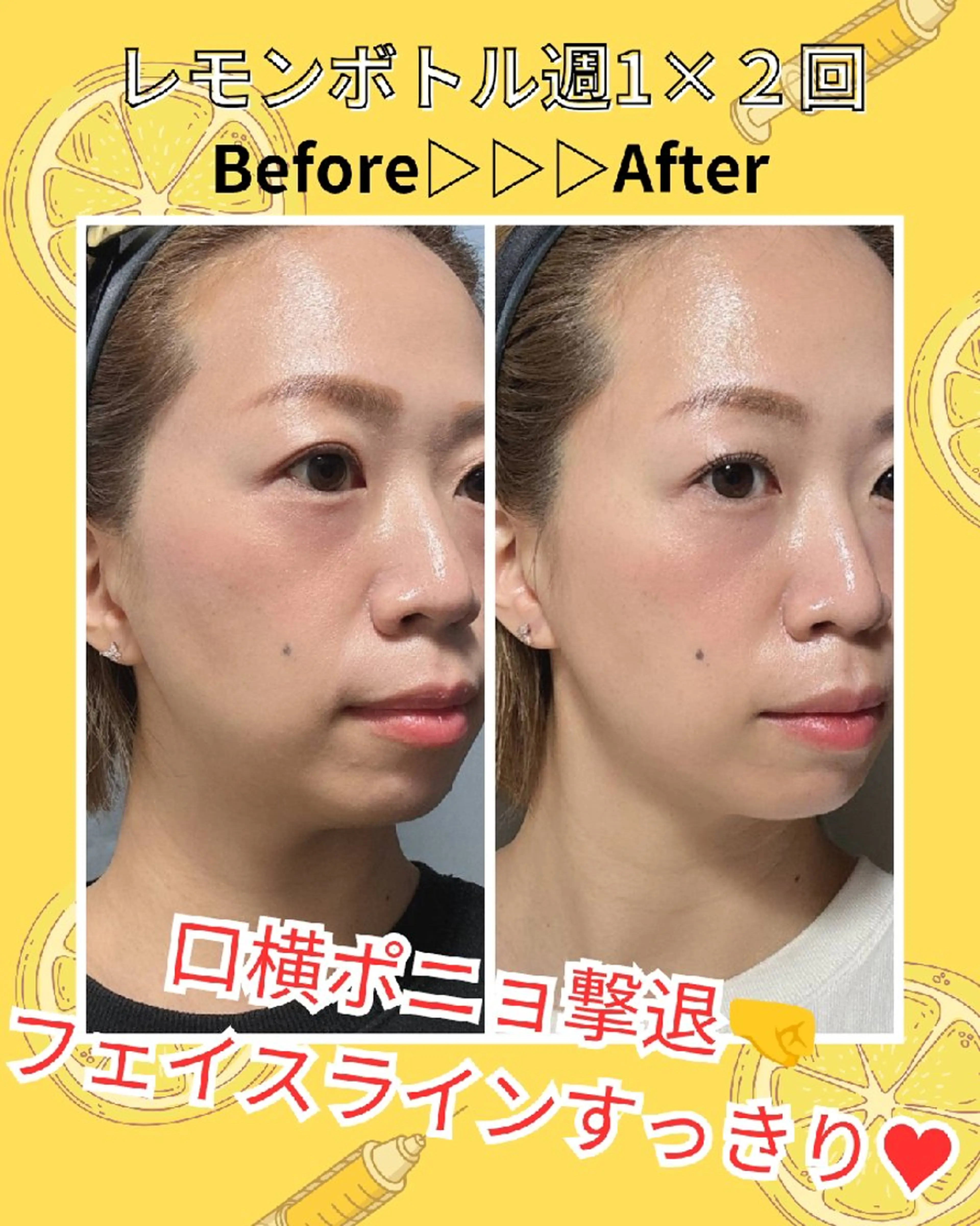 private salon TOWA所属・東洋✖️西洋痩身 TOWA♡関内馬車道のエステ・リラクイメージ