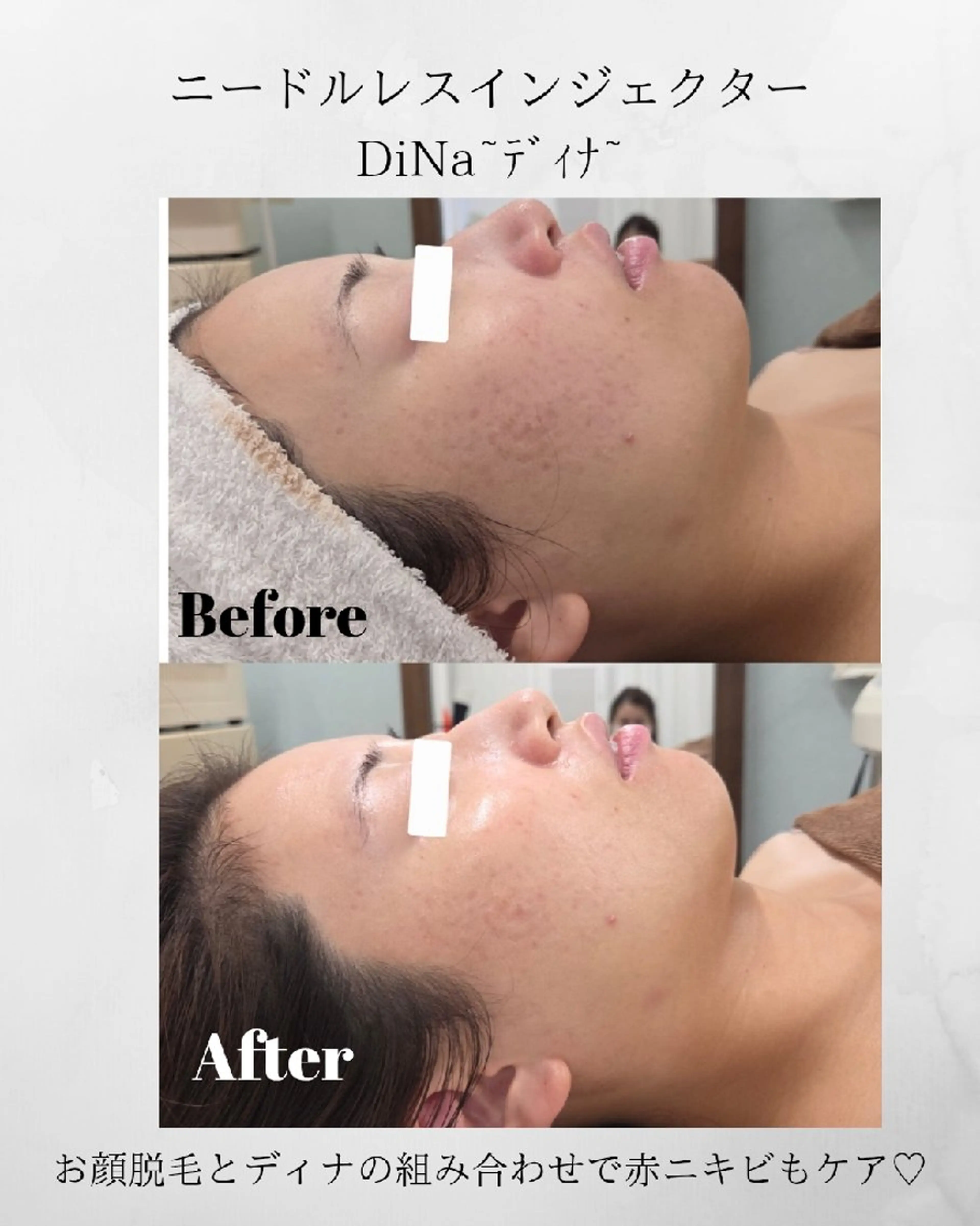 Belle〜ベル〜所属・エステサロン Belleのエステ・リラクイメージ