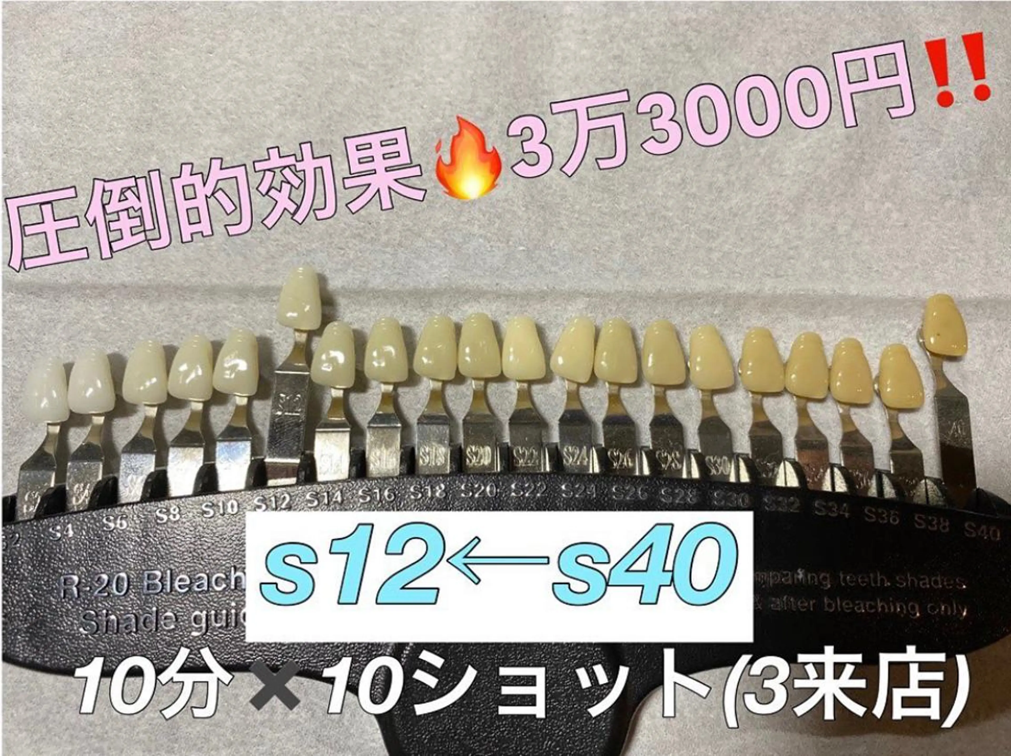 銀座de ホワイトニングのその他イメージ