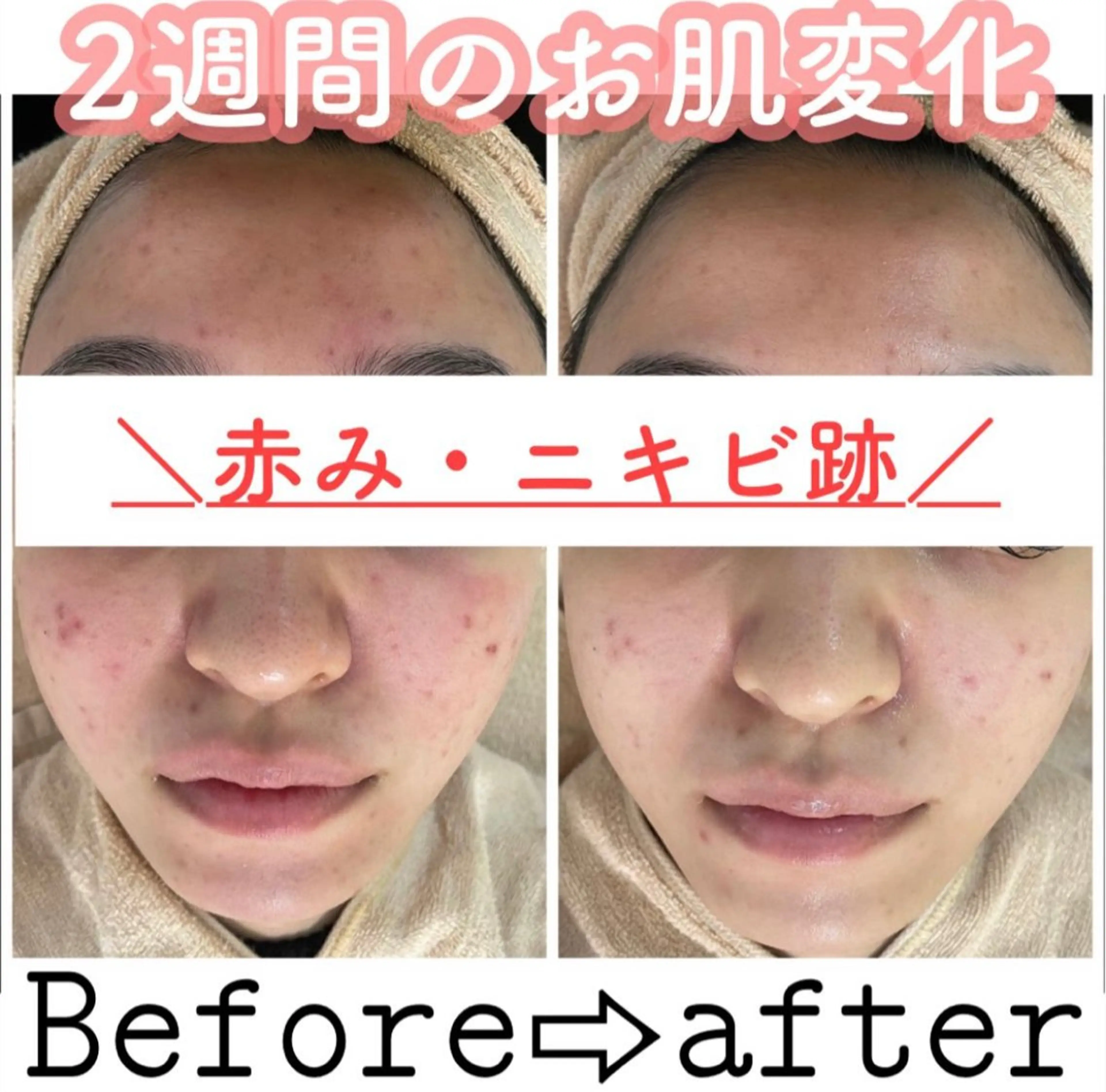 都度払い肌改善専門店 店長二上文香のエステ・リラクイメージ