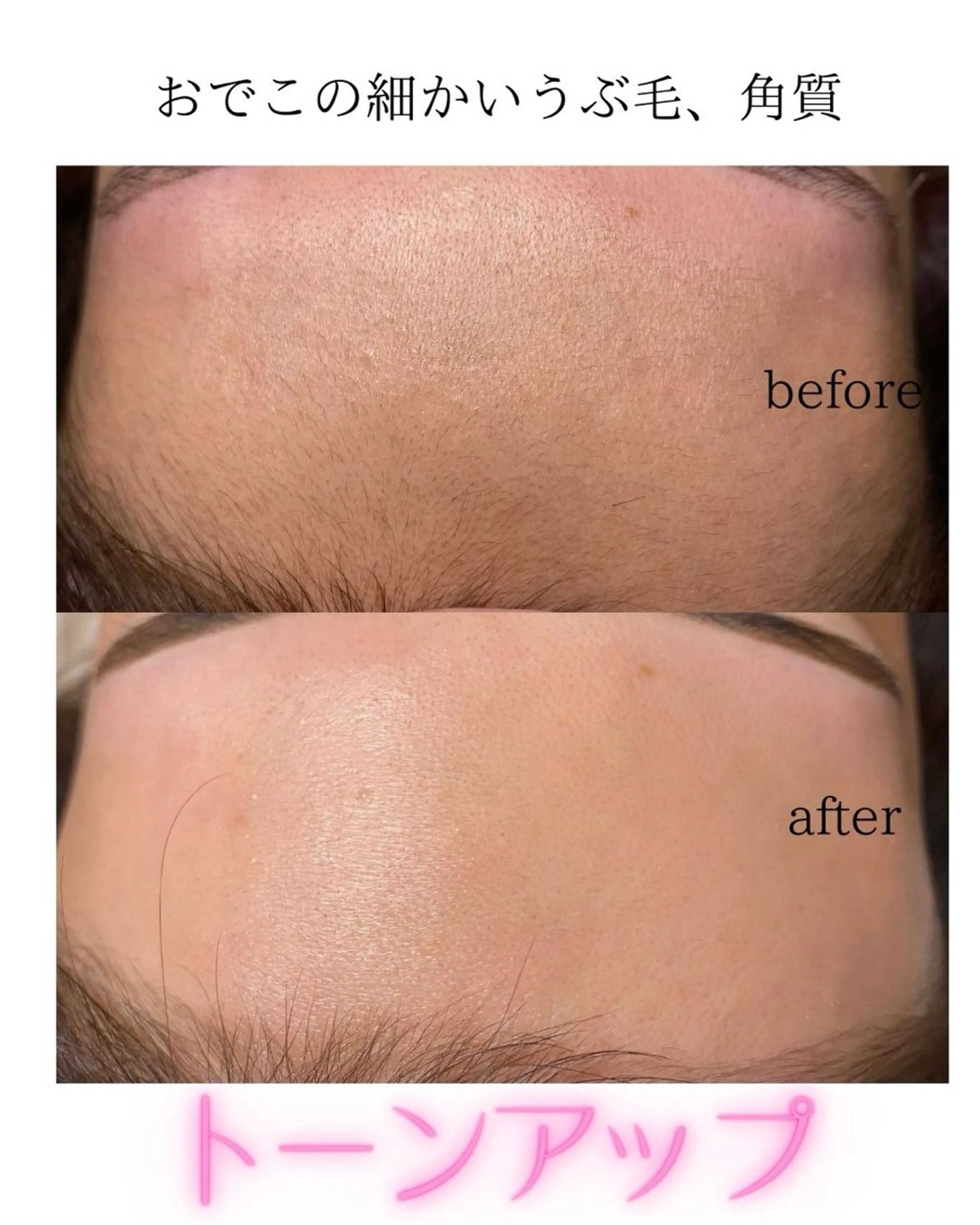 マツパ Nao店長 /ルヴォルテ大須のマツエク・マツパデザイン