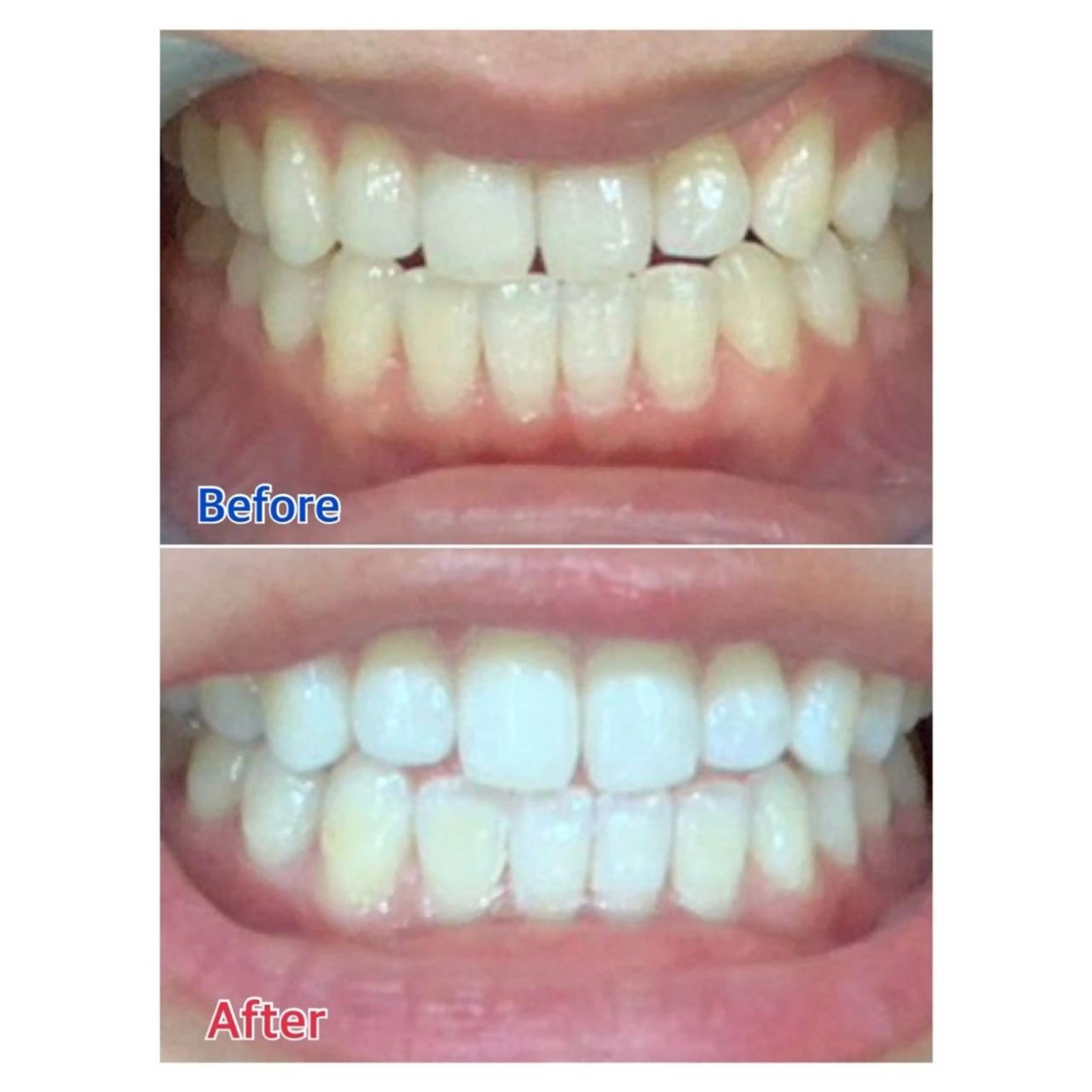 Melty 輝のその他イメージ