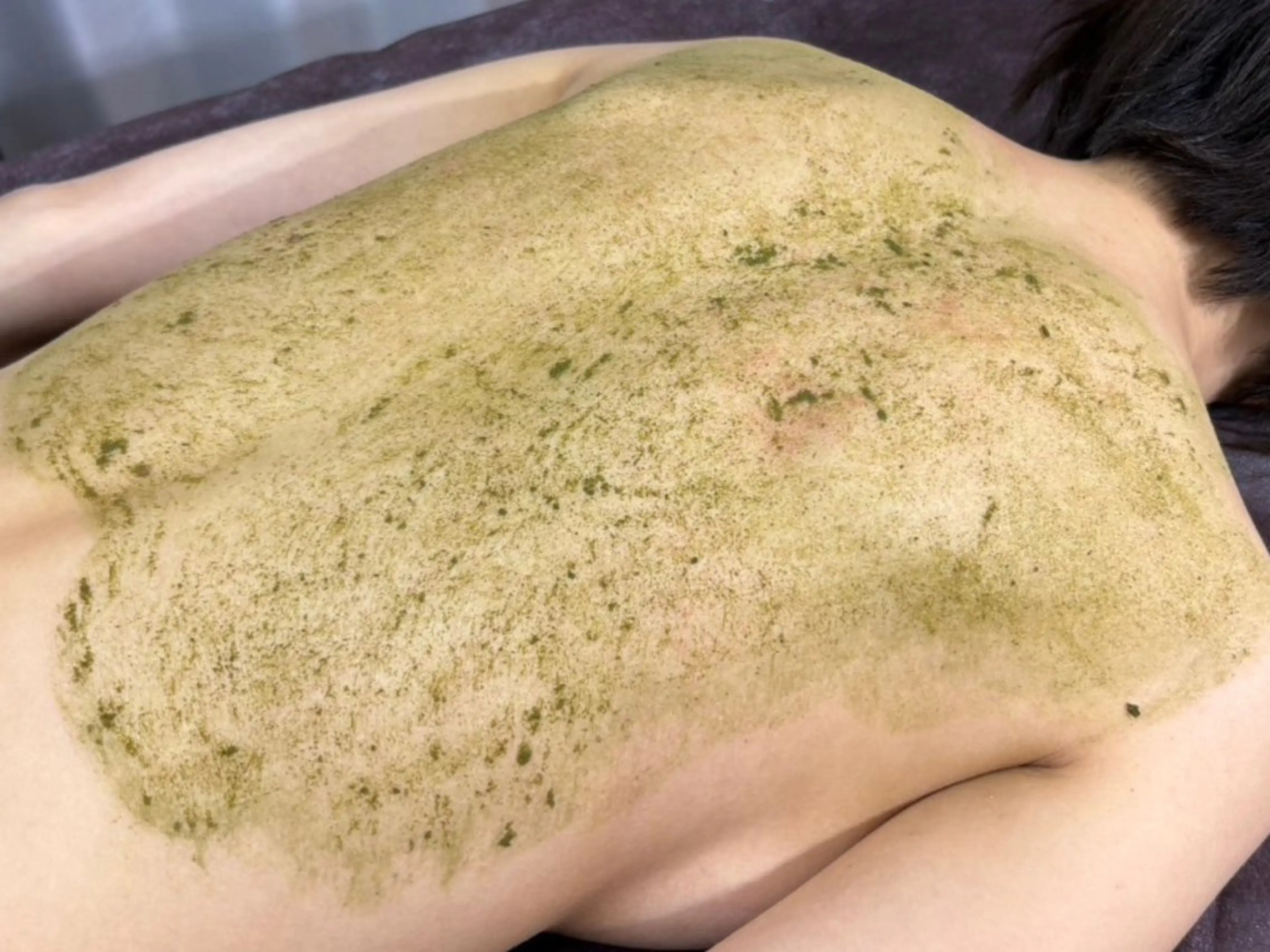 エステ 池袋ニキビ毛穴改善 🌿ハーブピーリングのエステ・リラクイメージ