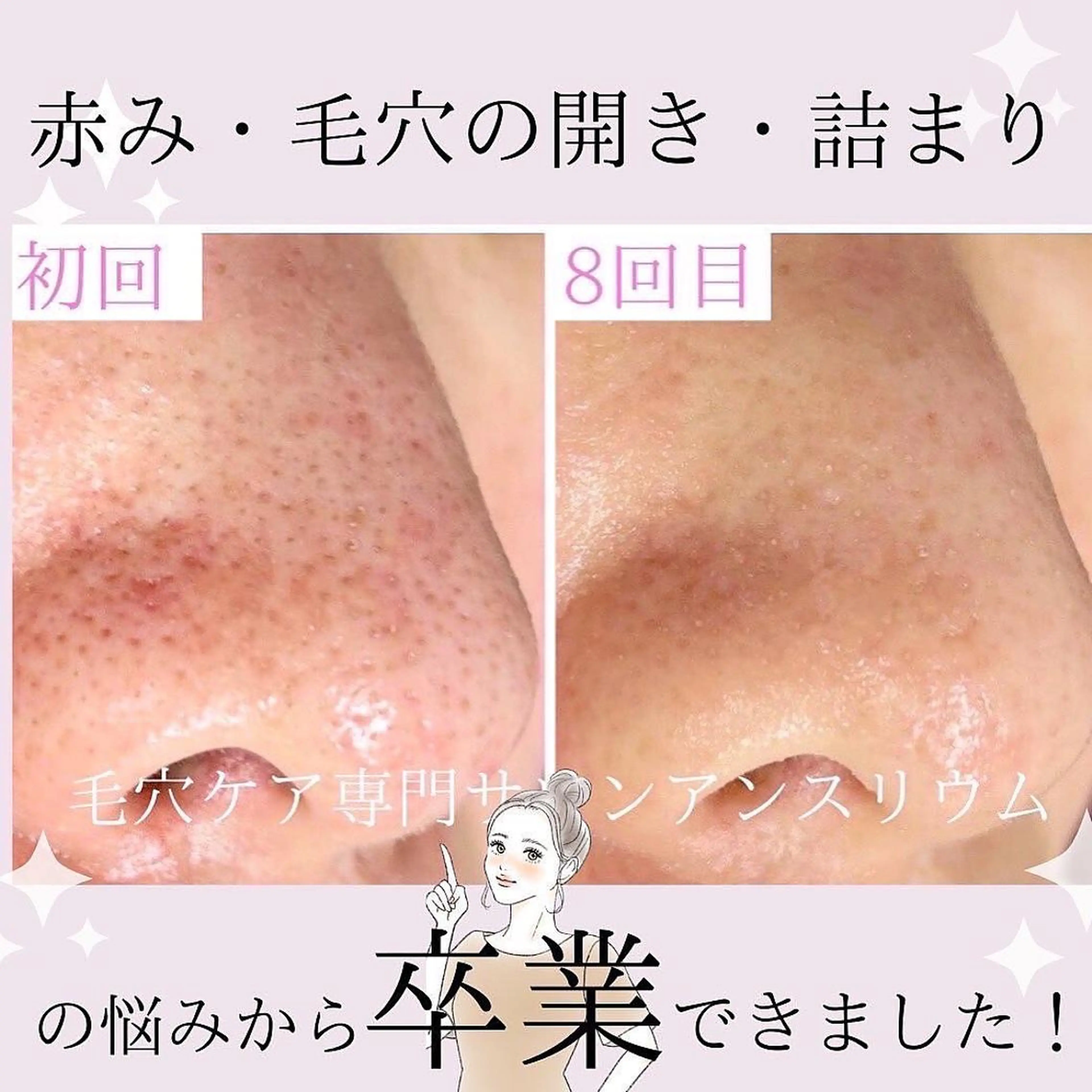 茨城土浦 つくば毛穴 ケア専門サロンのエステ・リラクイメージ