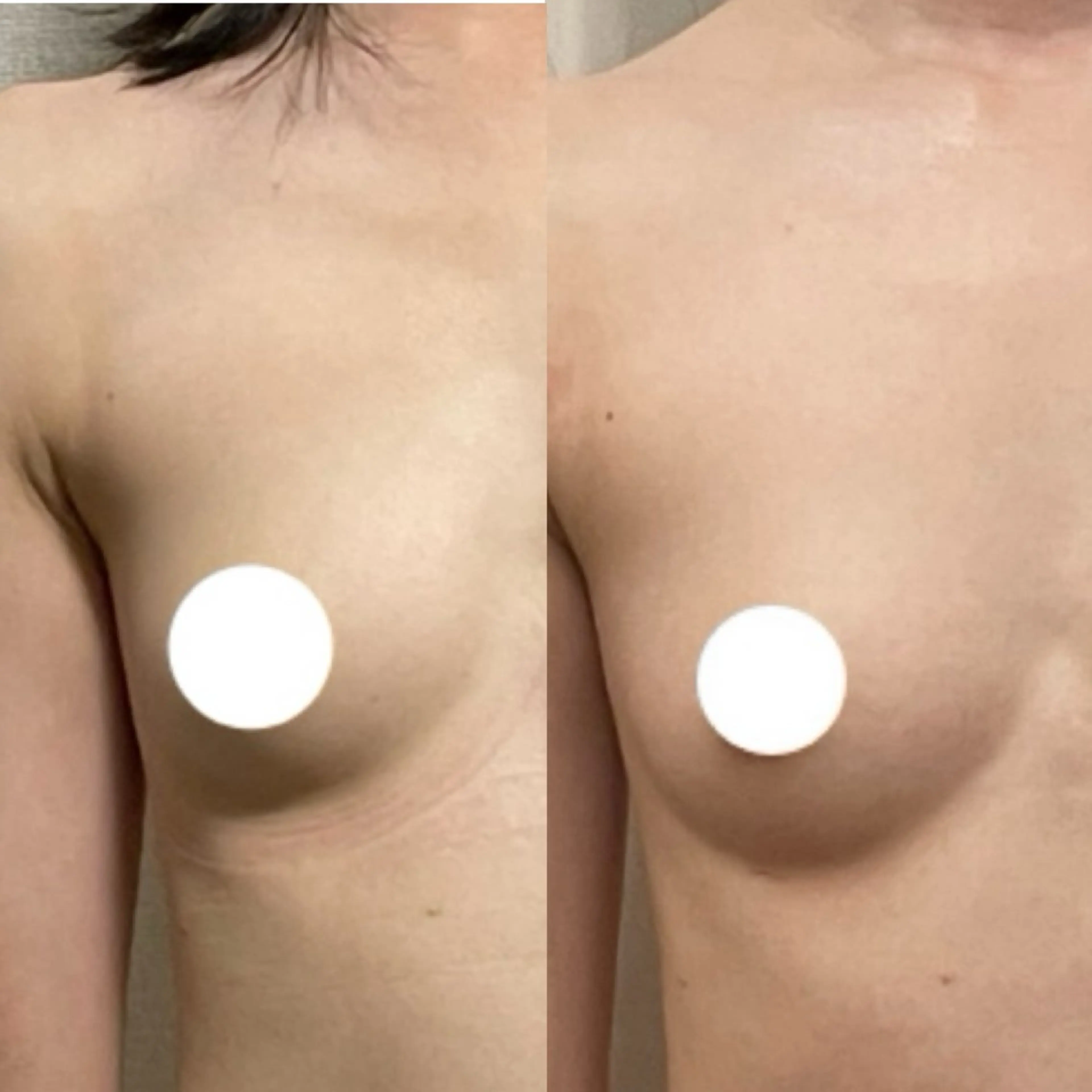 エステ リラク バストアップサロン 💎MARINE💎のエステ・リラクイメージ