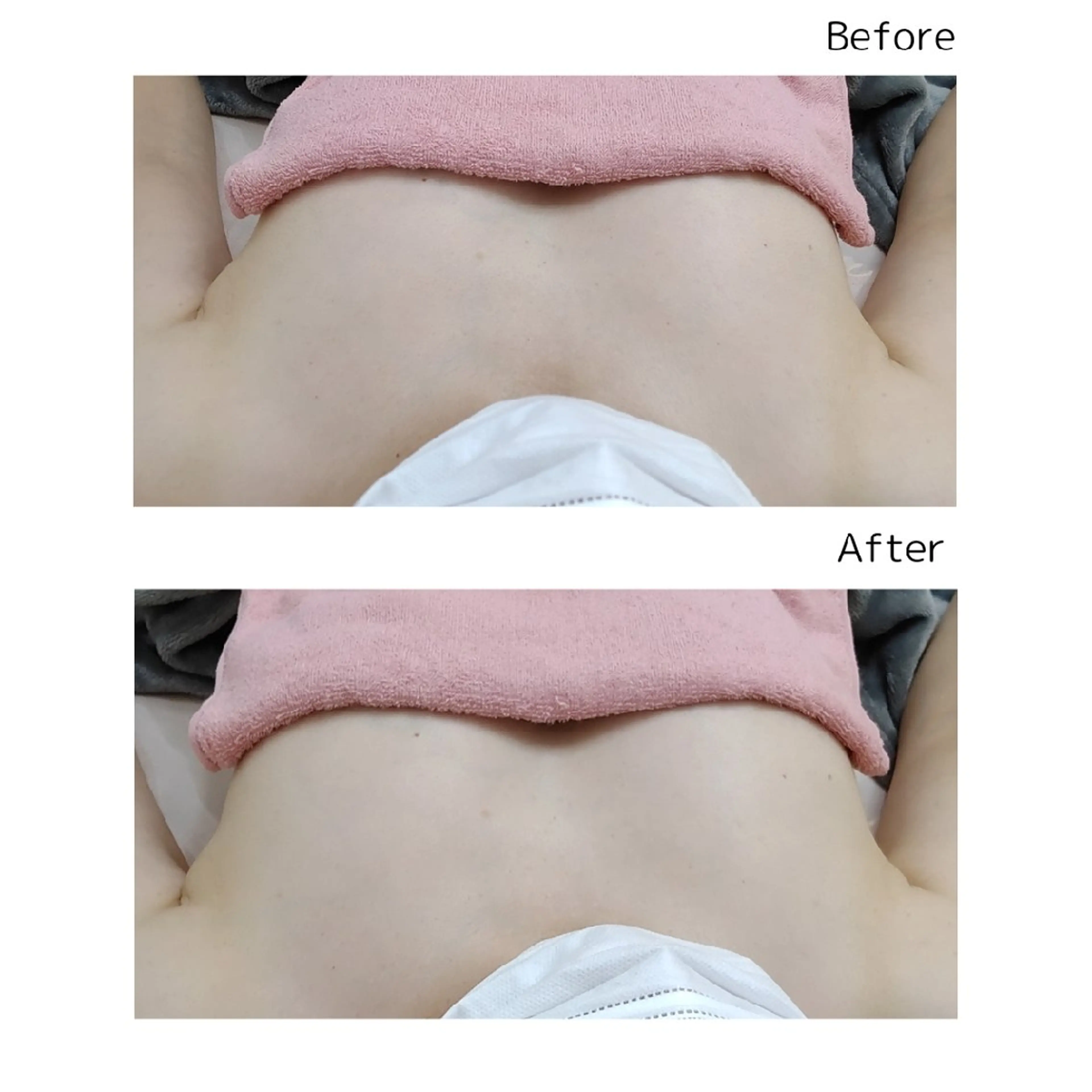 佐賀痩身エステ/小顔 @uni.clearのエステ・リラクイメージ