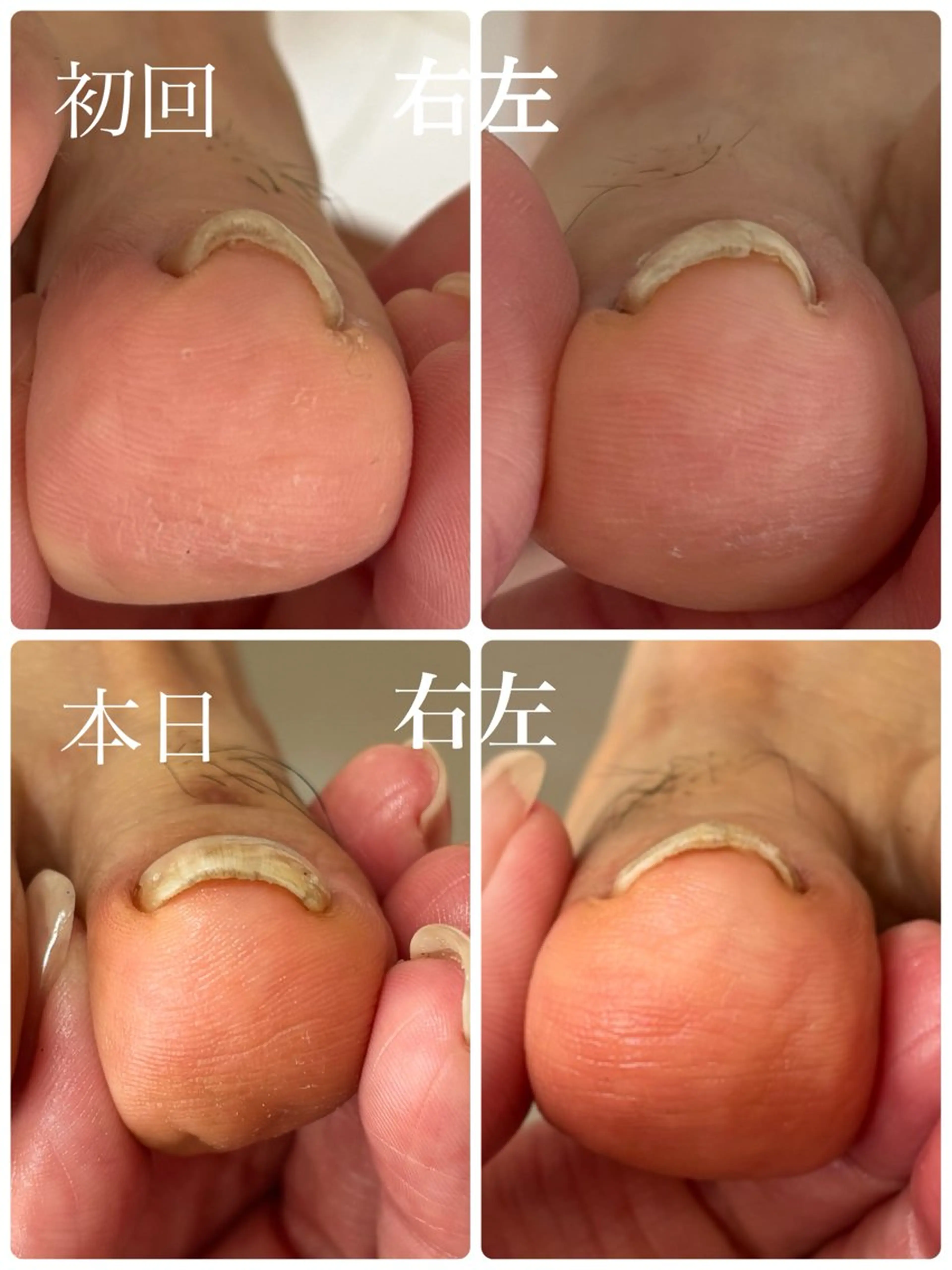 ネイル Alo.nail アロ•ネイルのネイルデザイン