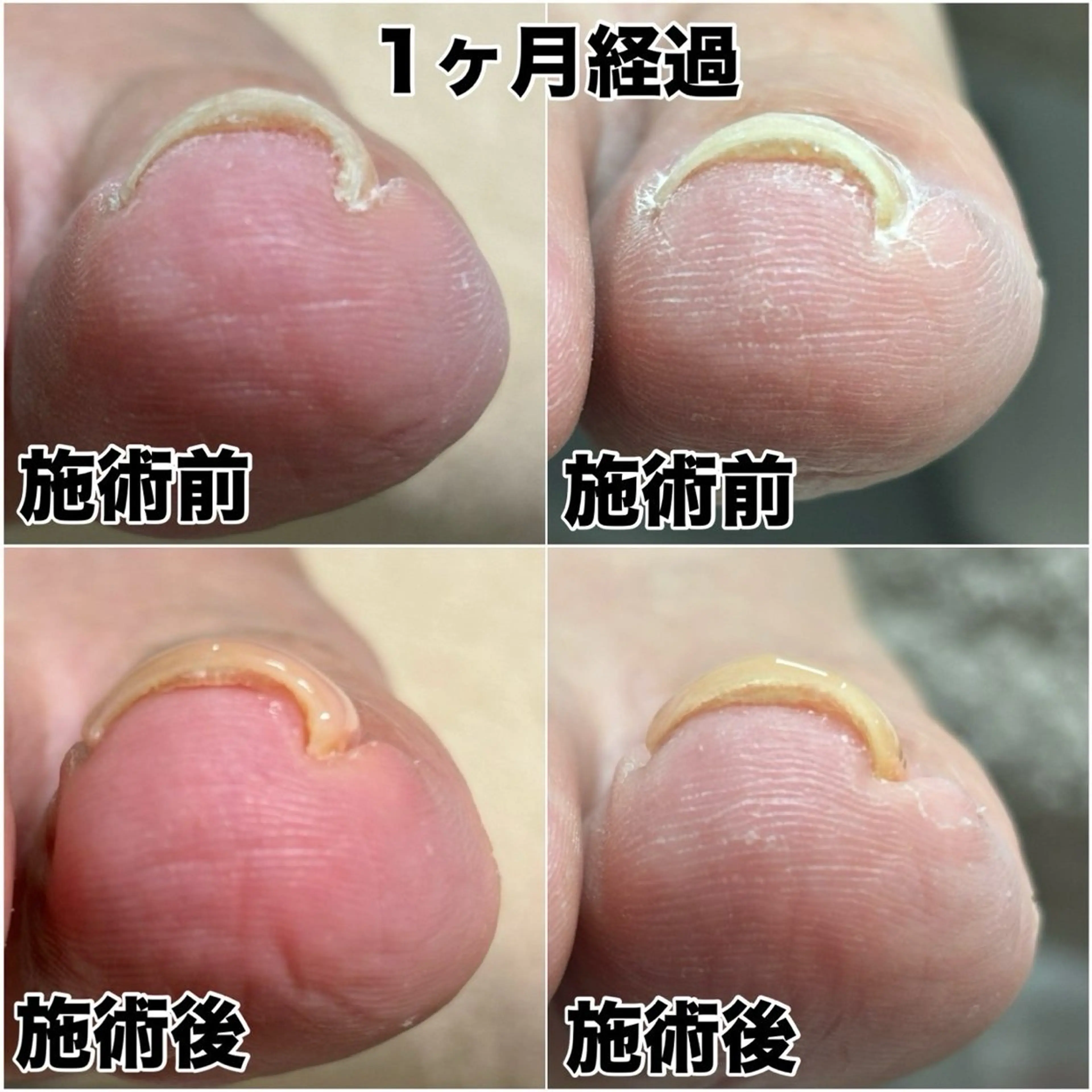 ネイル BellaLuna NAILのネイルデザイン