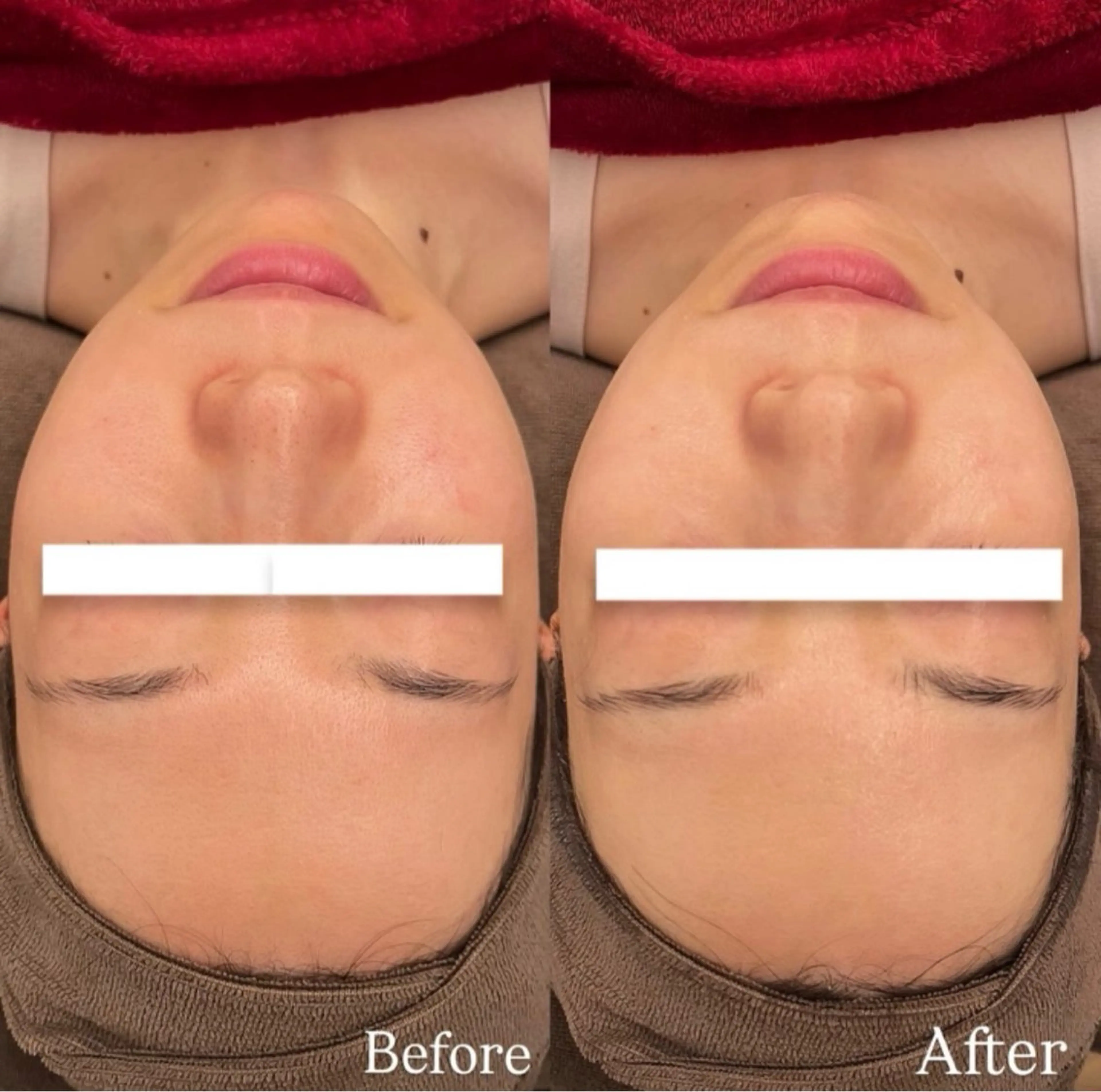 脱毛 Dioe 自由が丘のエステ・リラクイメージ