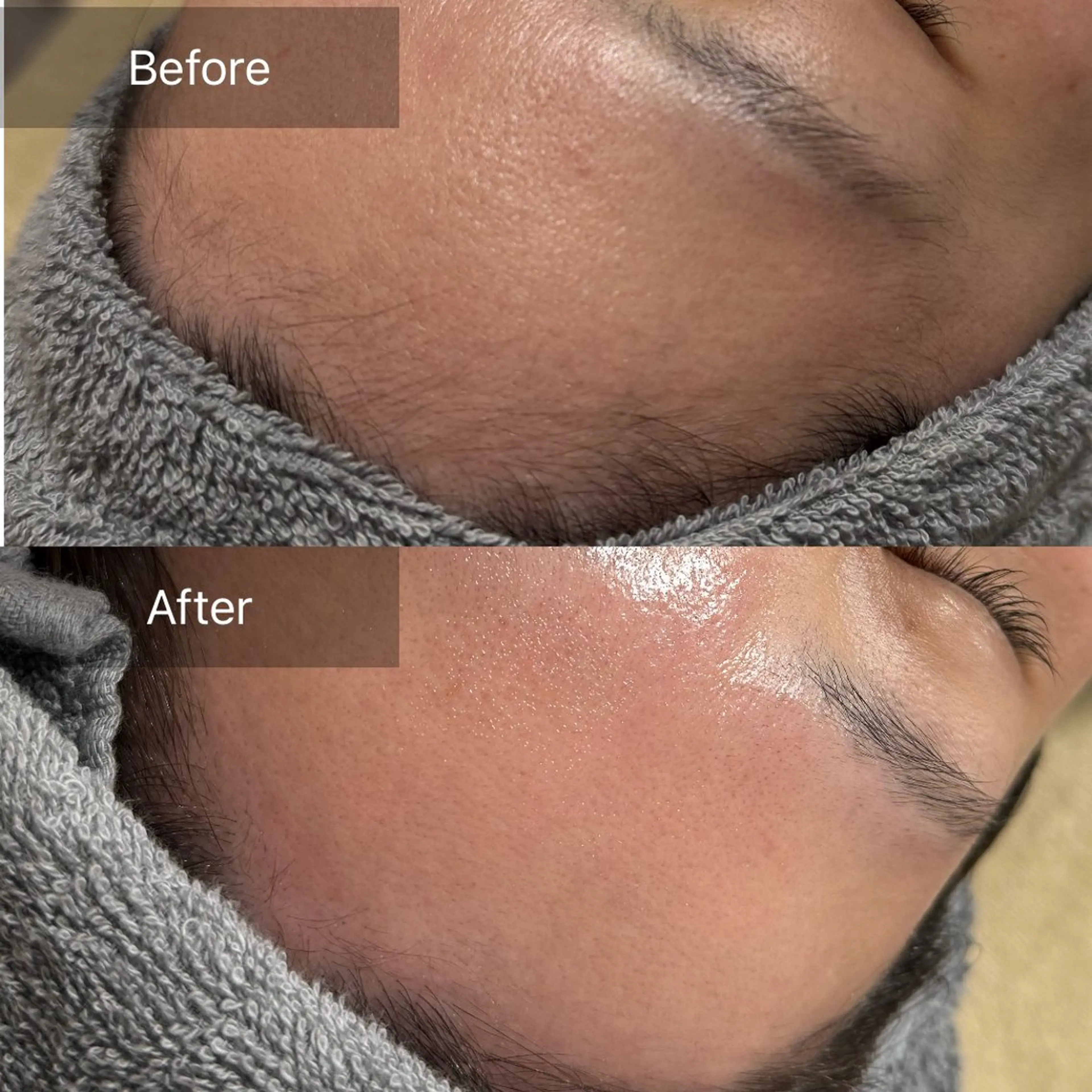 脱毛 enine所属・enine フェイスWAXのエステ・リラクイメージ