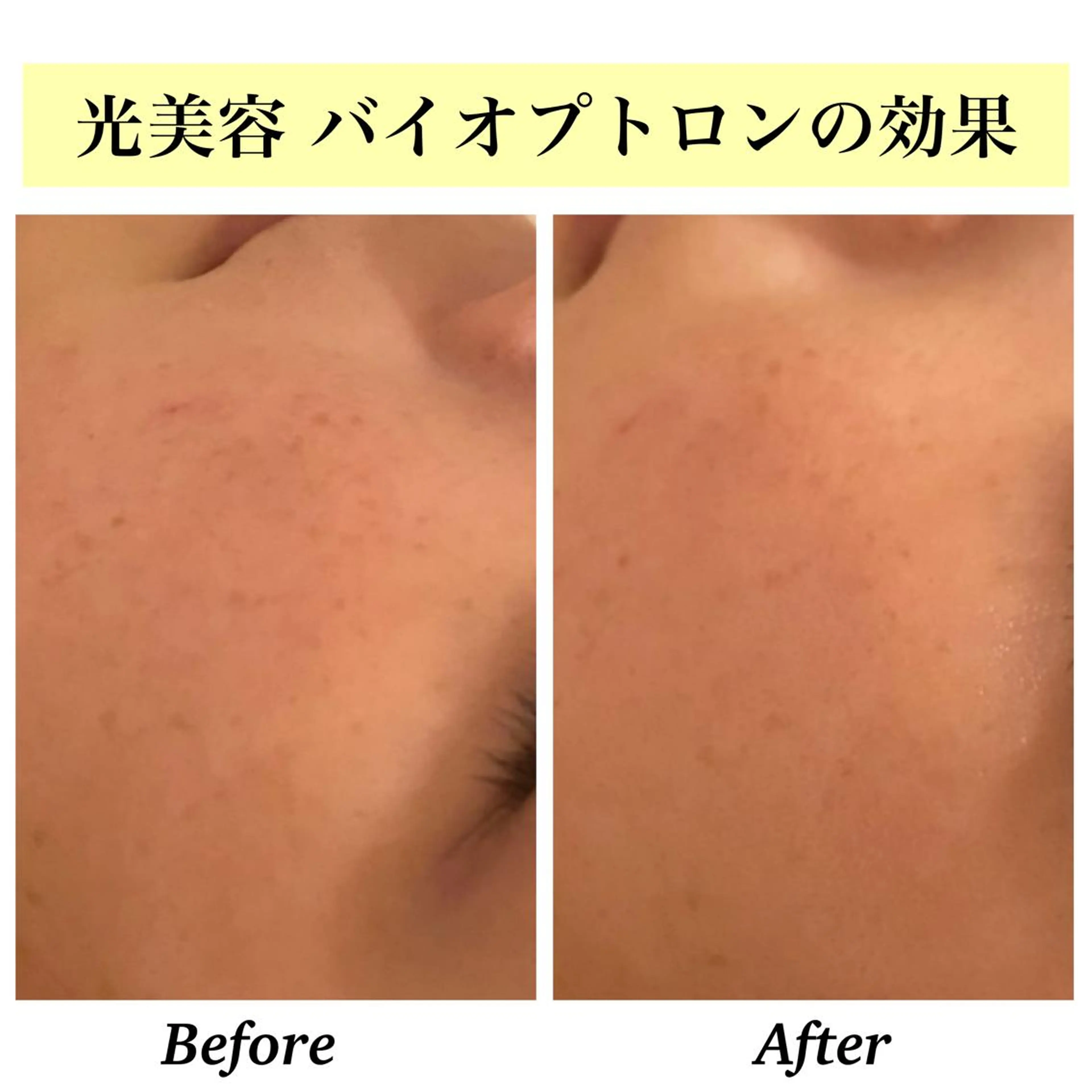 エステ リラク Bellesthe (ベルエステ)のエステ・リラクイメージ