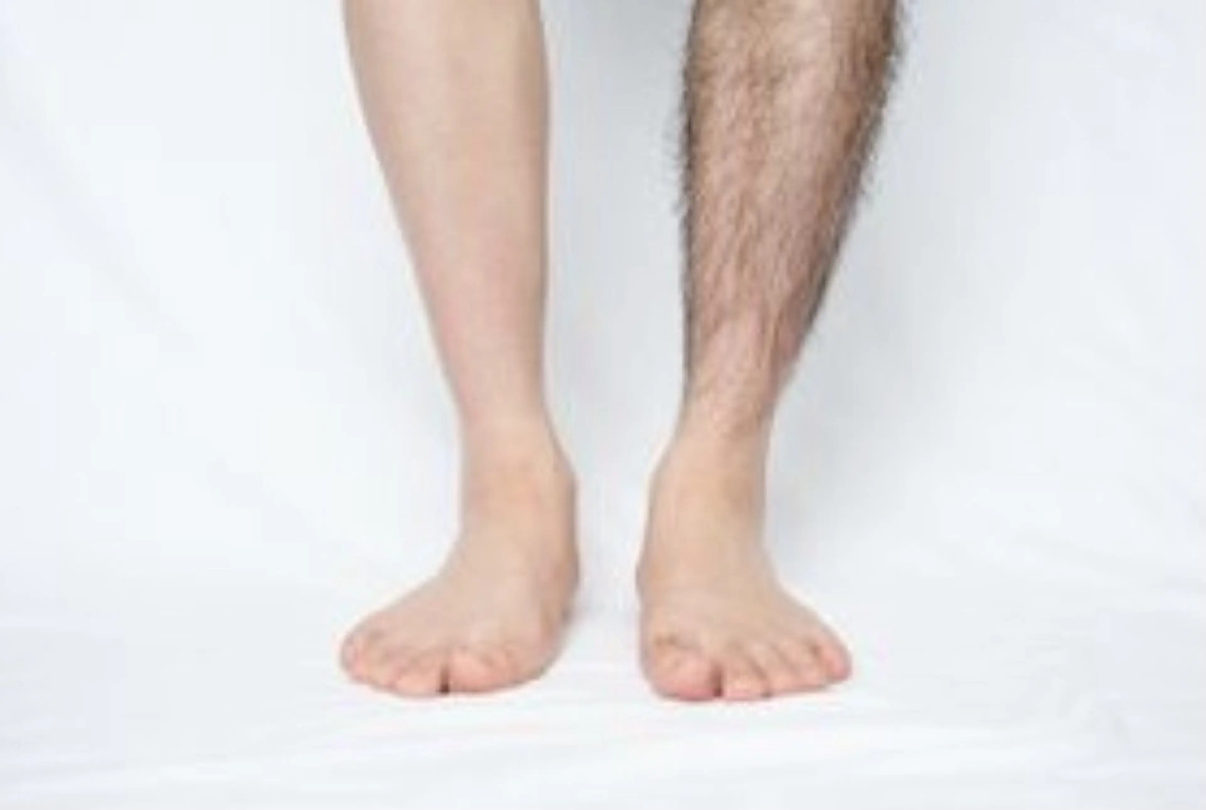 メンズ✨セレクト脱毛✨選べる2か所✨の写真