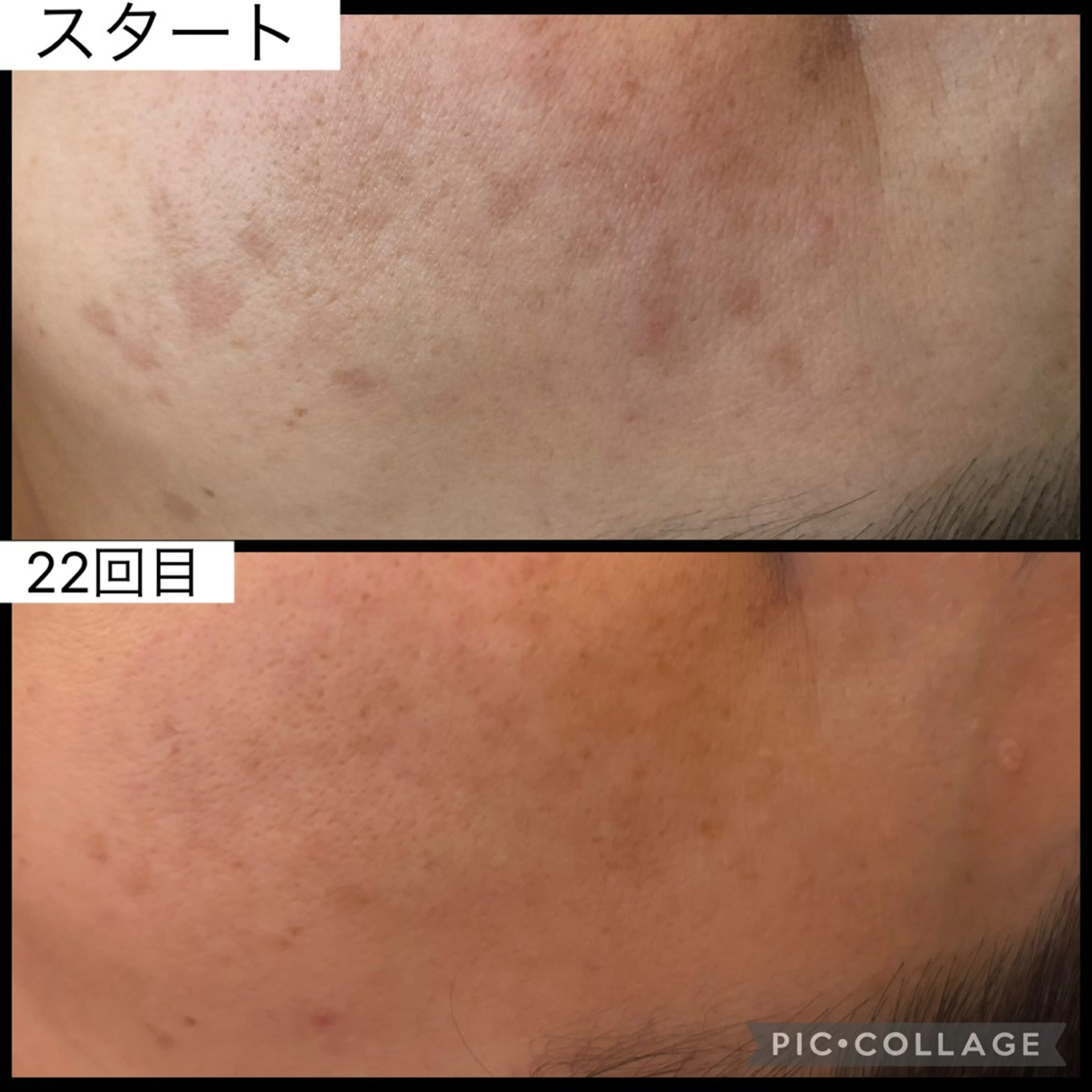 Brightブライト (エステ.リラク)のエステ・リラクイメージ