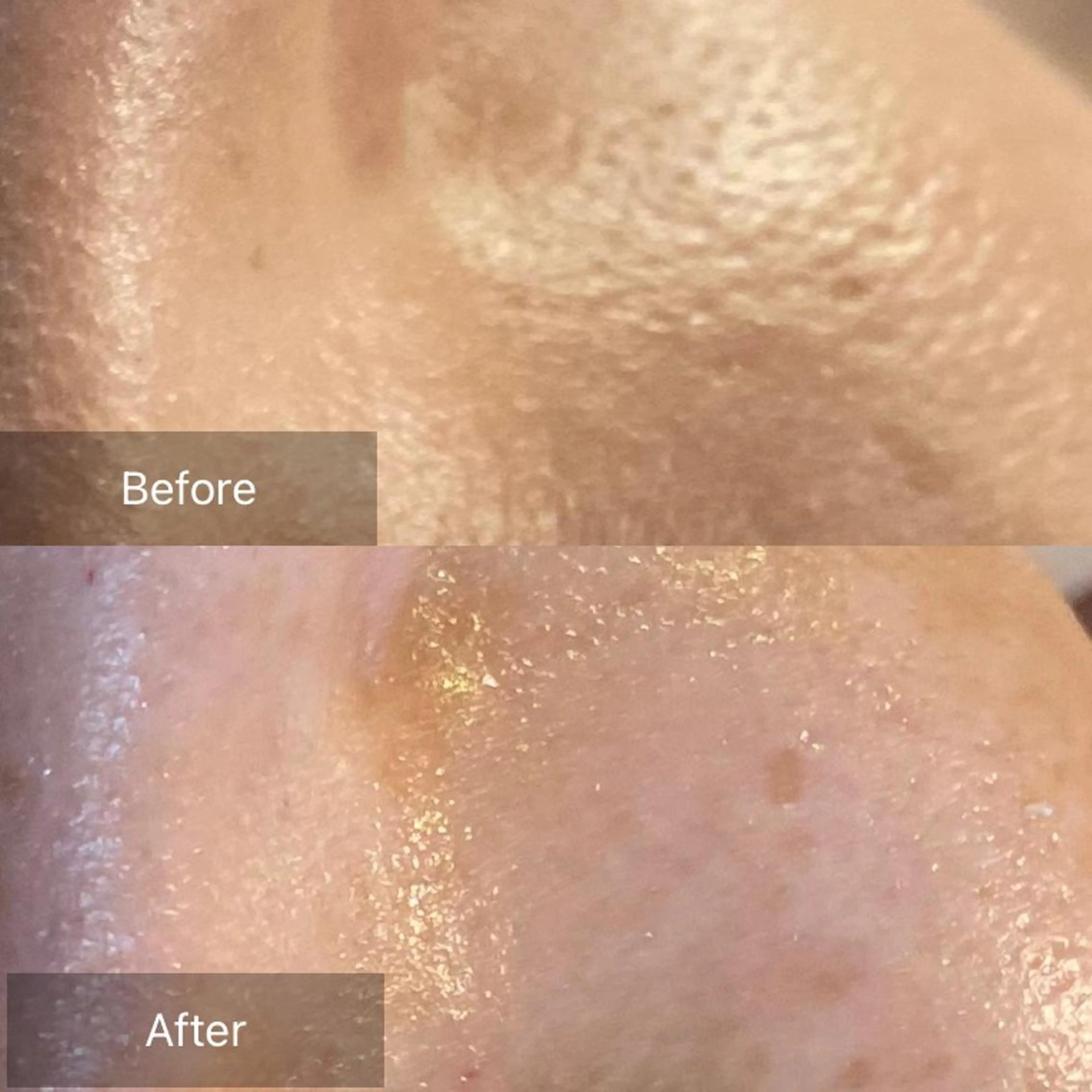 毛穴から始める肌メン テマンダリンオレンジのエステ・リラクイメージ