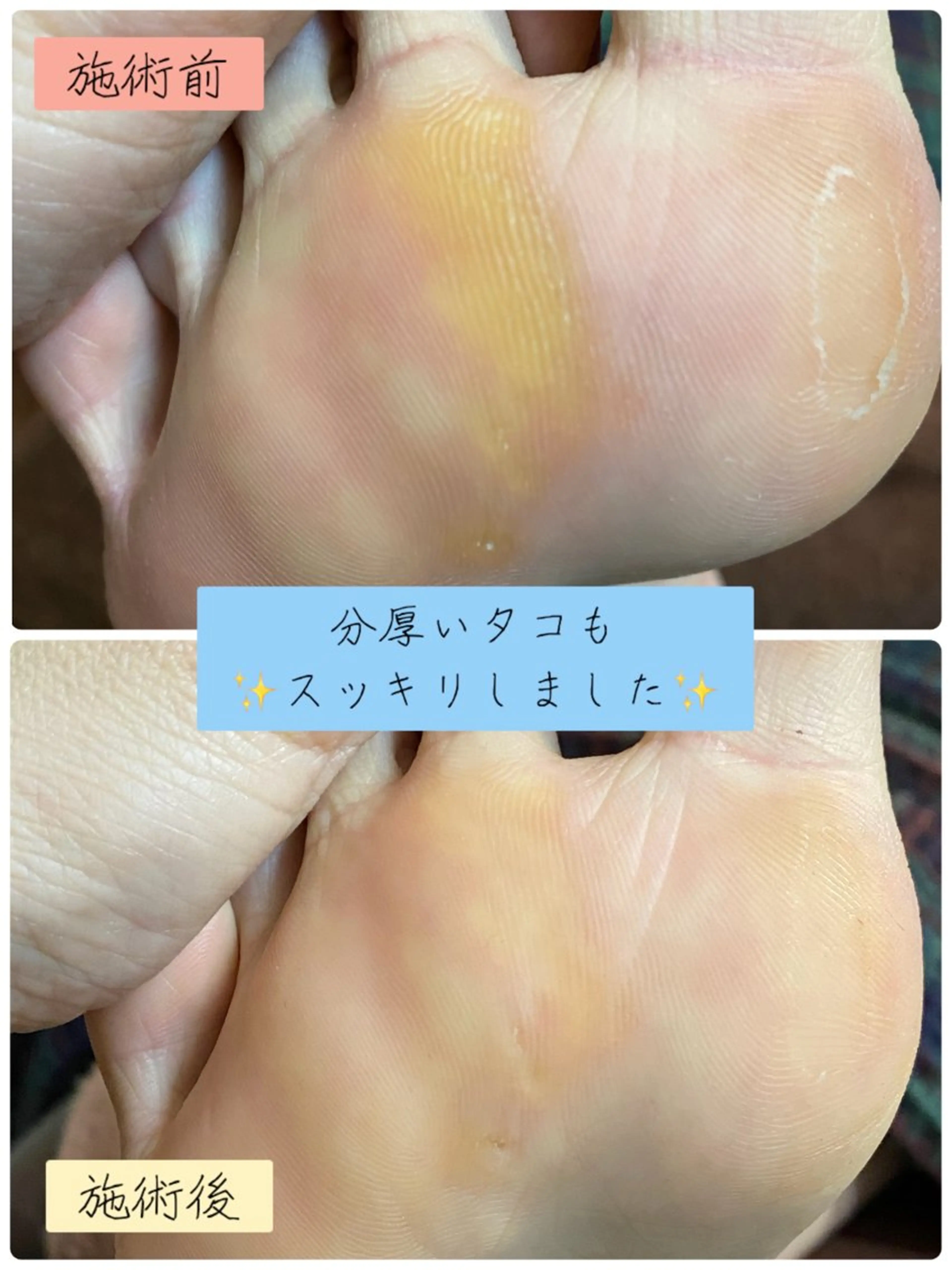 フットネイル Studio Jivanのネイルデザイン