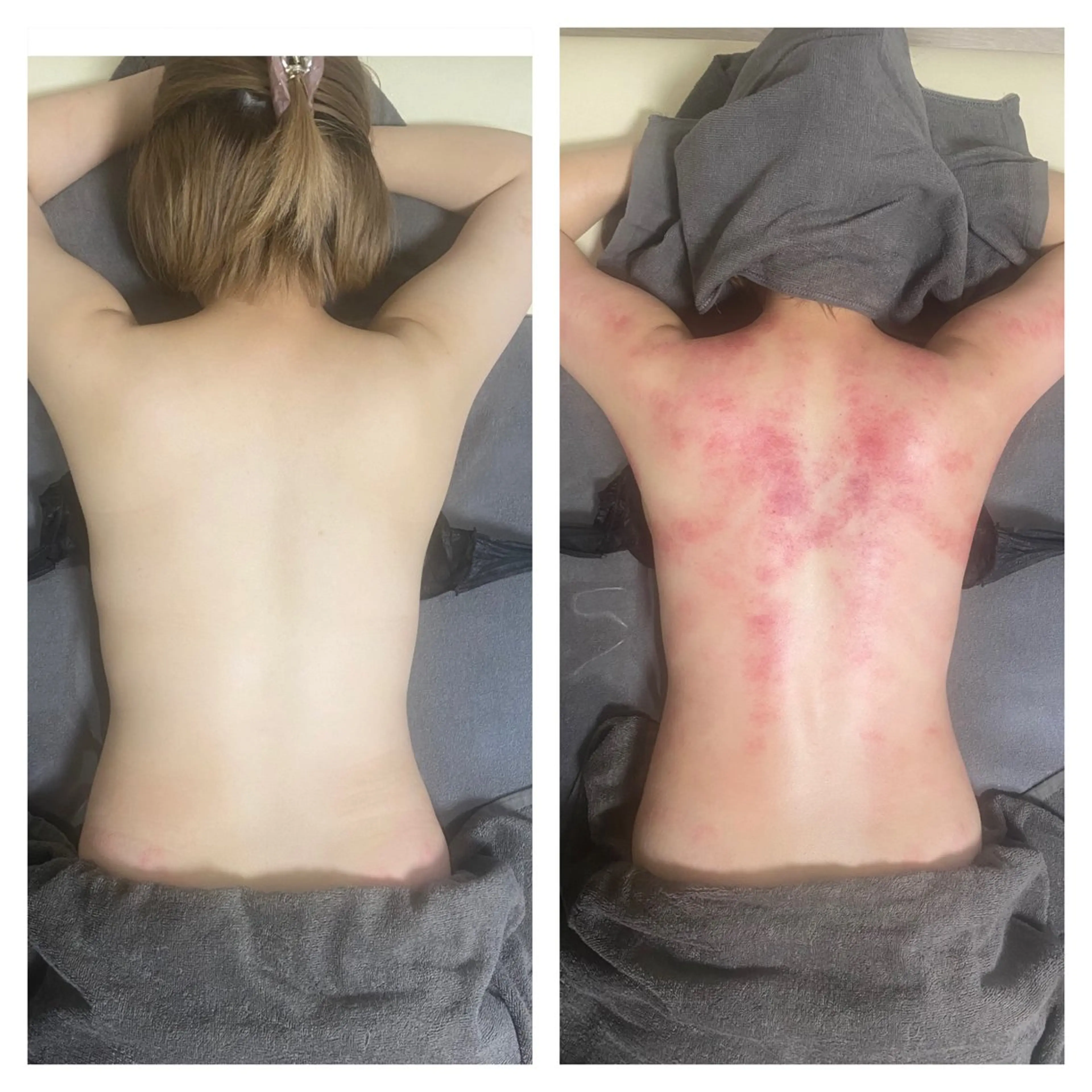 セルライトクラッシュ ＆腸もみ＋骨盤矯正のエステ・リラクイメージ