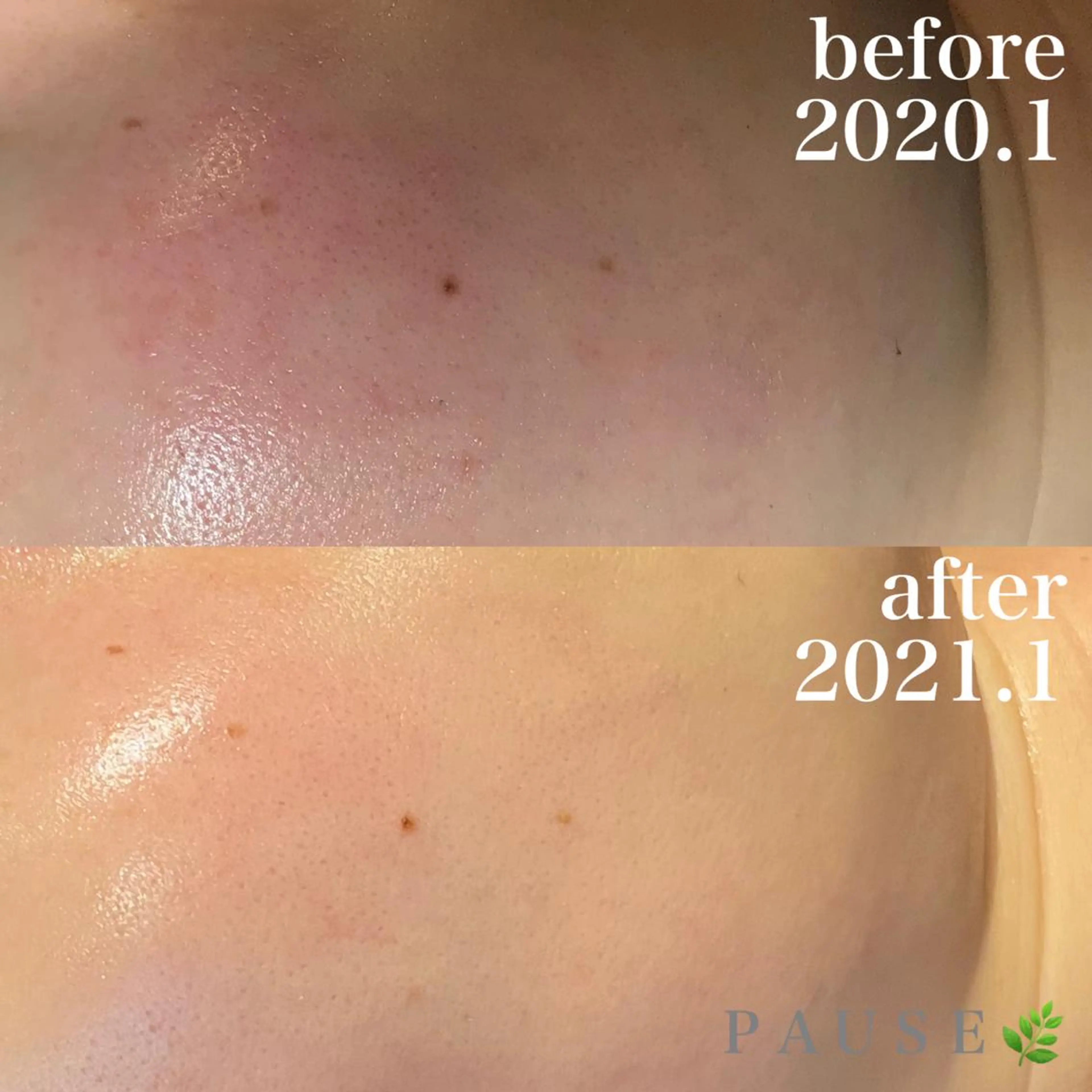 エステ 浜野 恵美のエステ・リラクイメージ