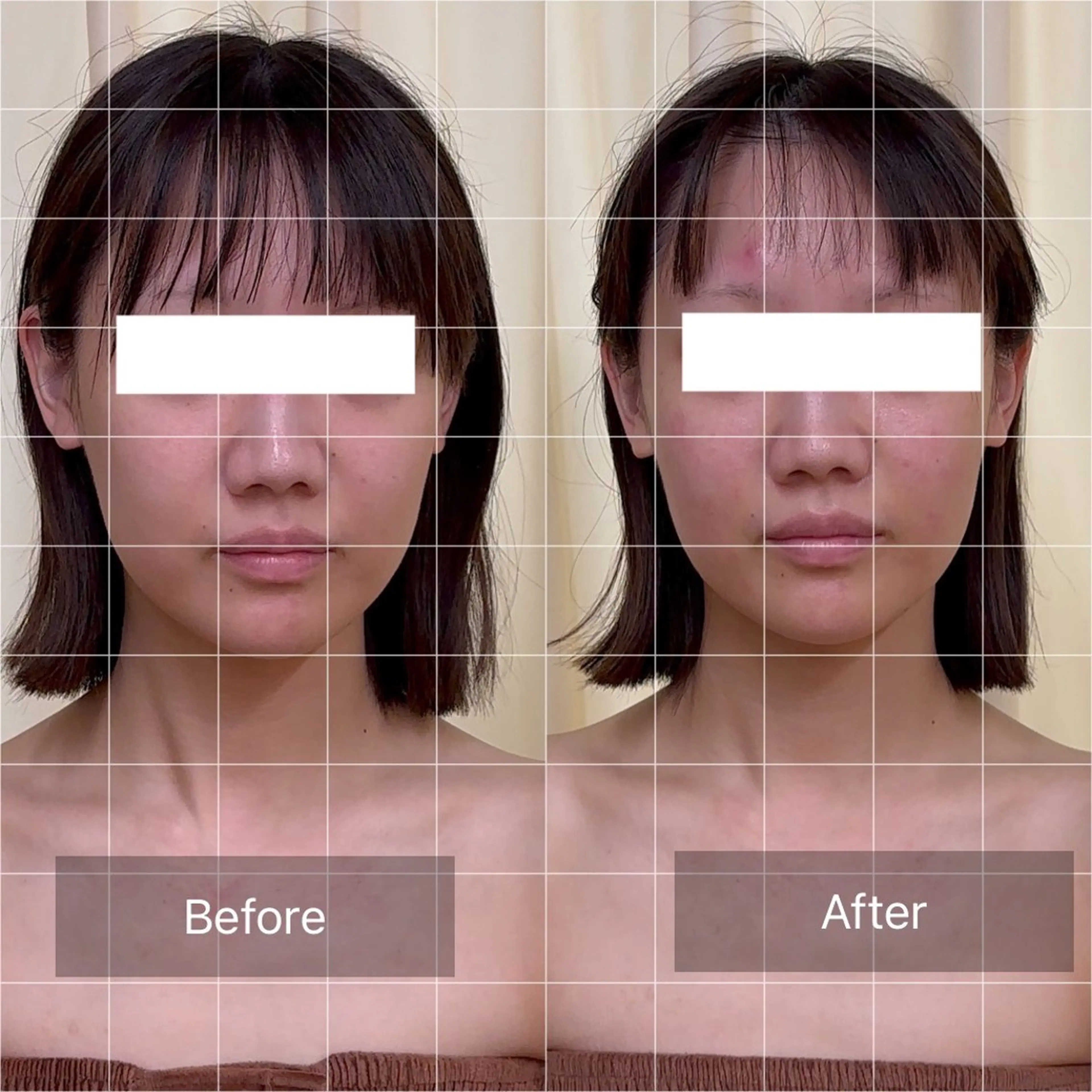 その他 BBB3(ビースリー)所属・鍼灸サロン BBB3のその他イメージ