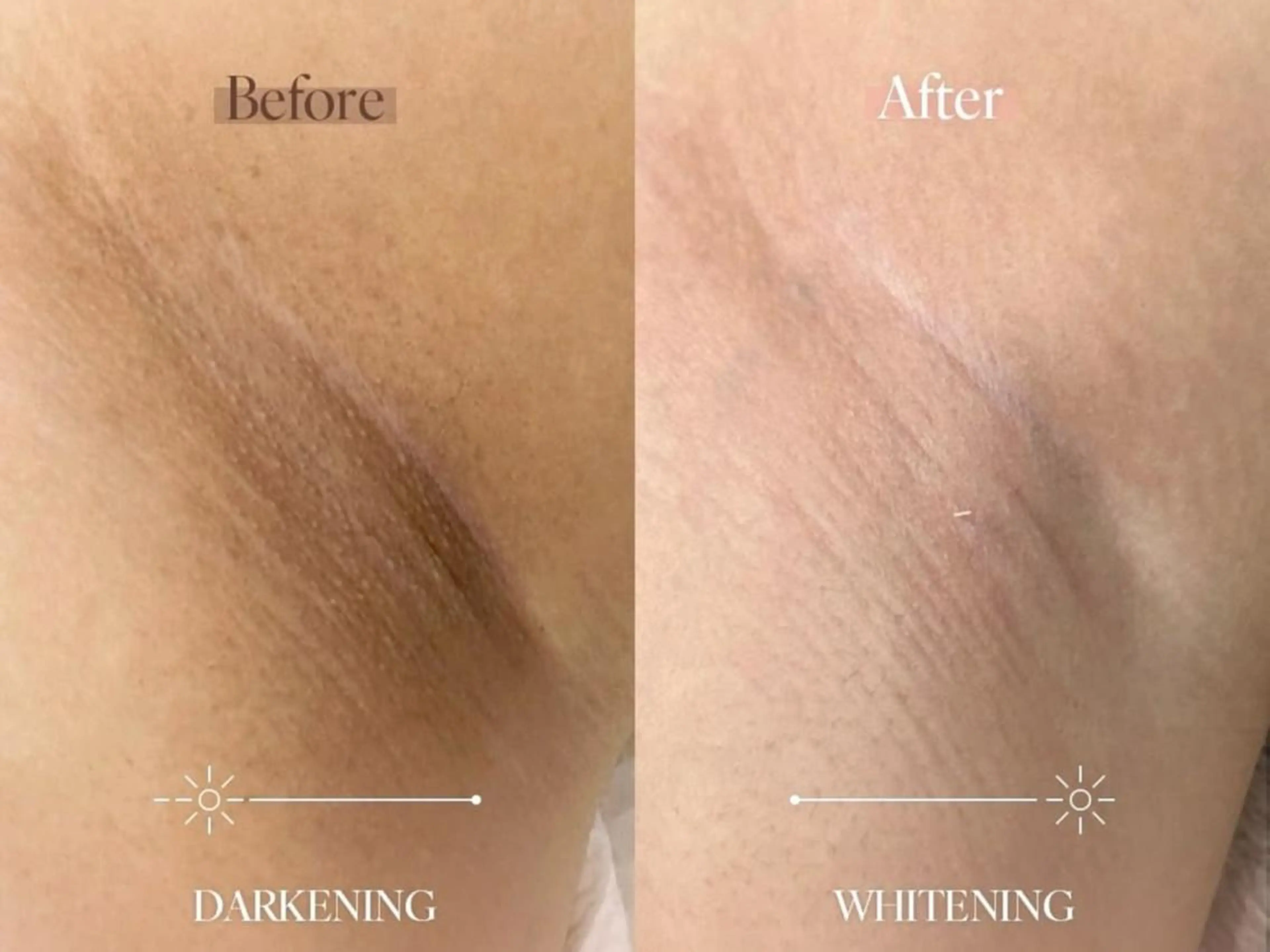 エステ M FLOAT skin salonのエステ・リラクイメージ