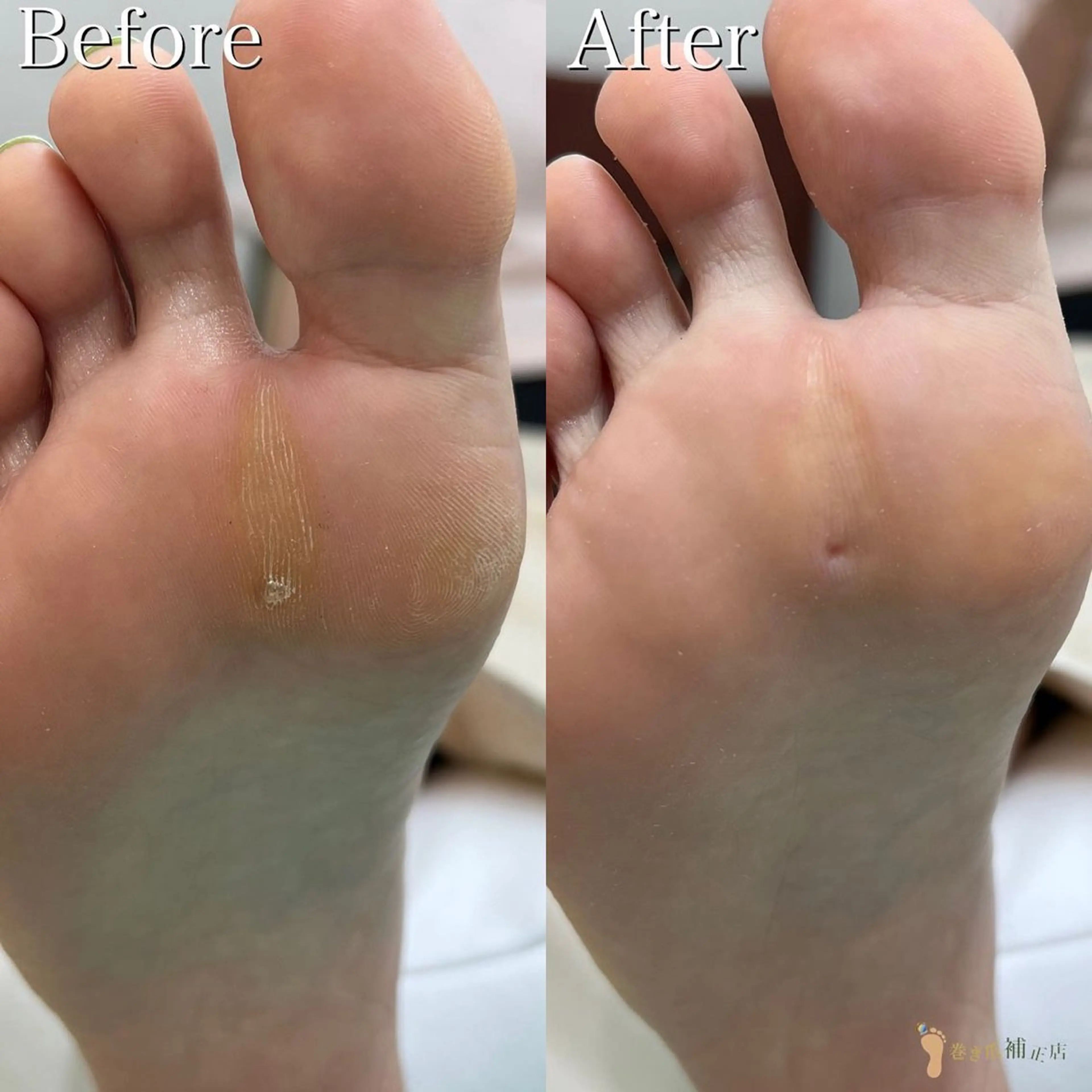 巻き爪補正店 町田店のその他イメージ