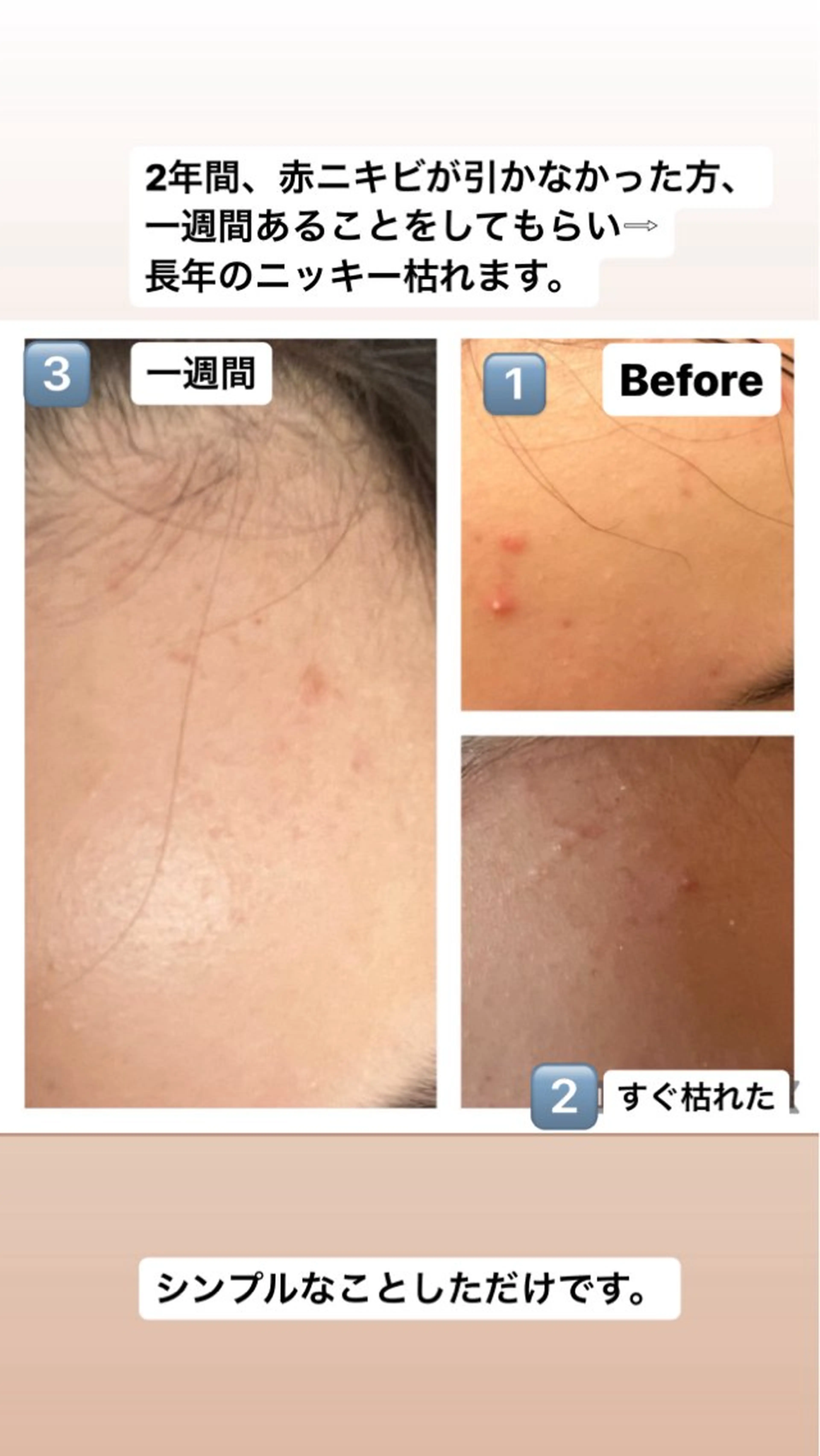 🅖🅤🅩🅔🅛 salonのエステ・リラクイメージ