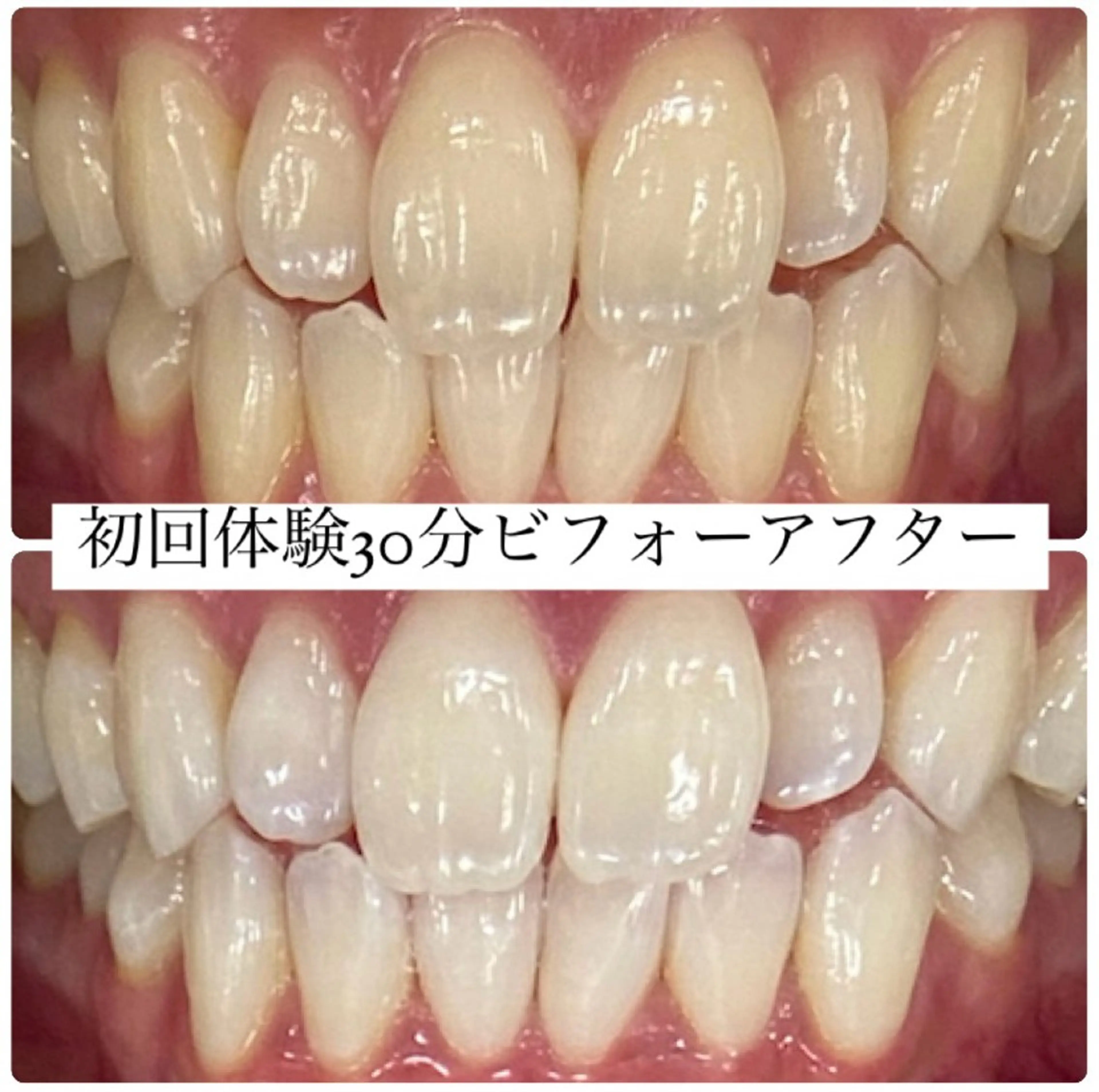 ホワイトニングルーム 横浜店のその他イメージ