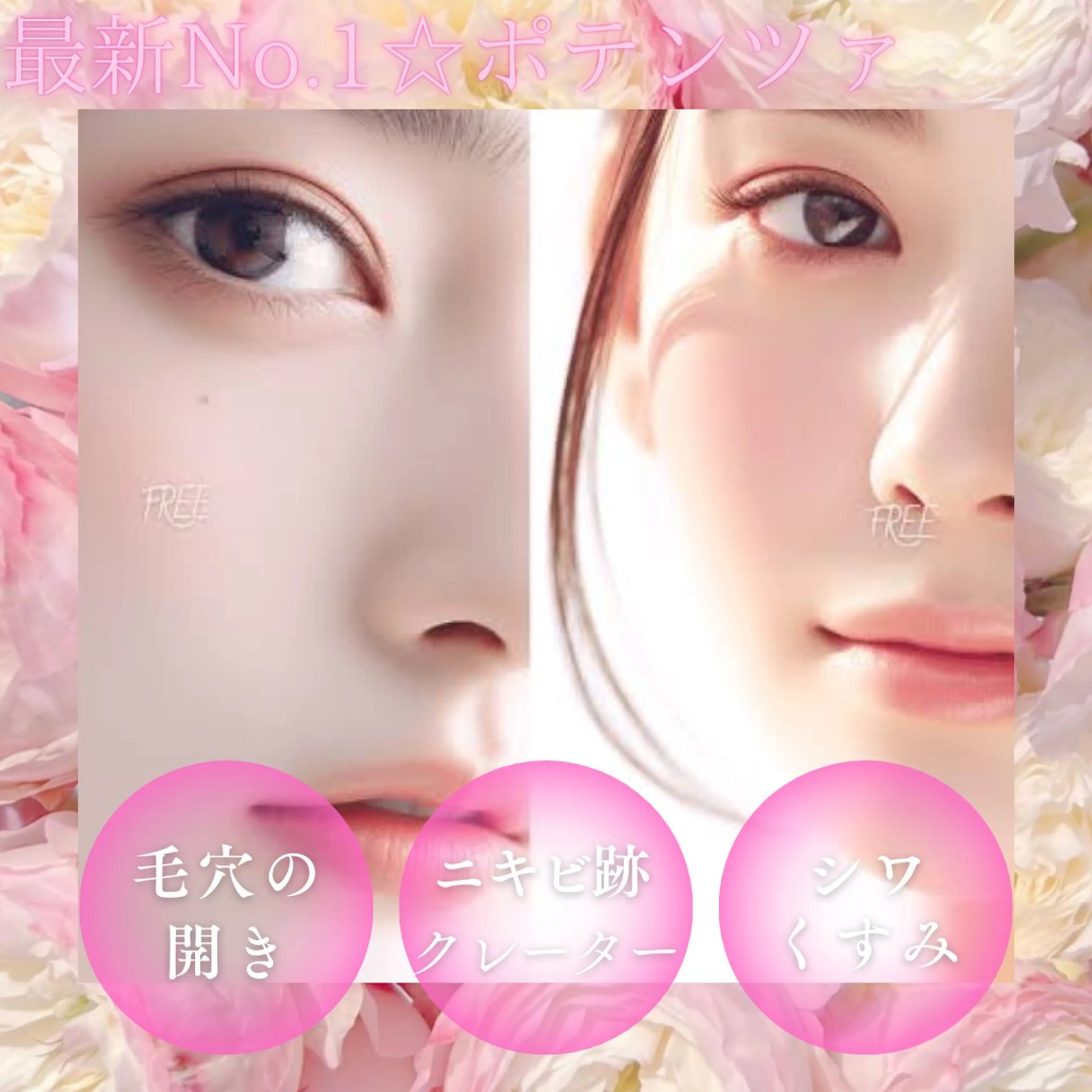 最新No.1☆毛穴引き締め　19800円の写真