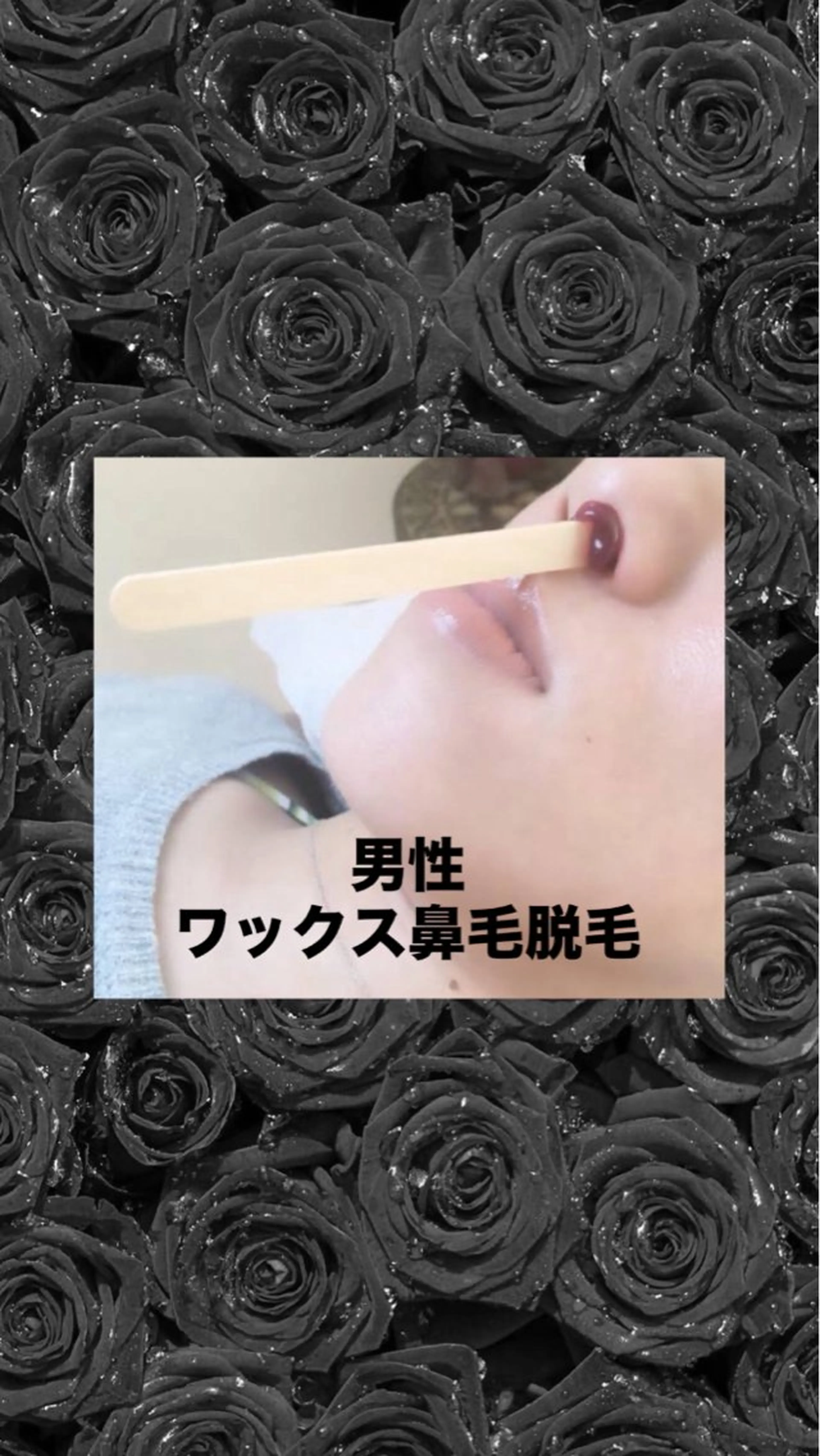 脱毛 メディカルエステ マドンナのエステ・リラクイメージ