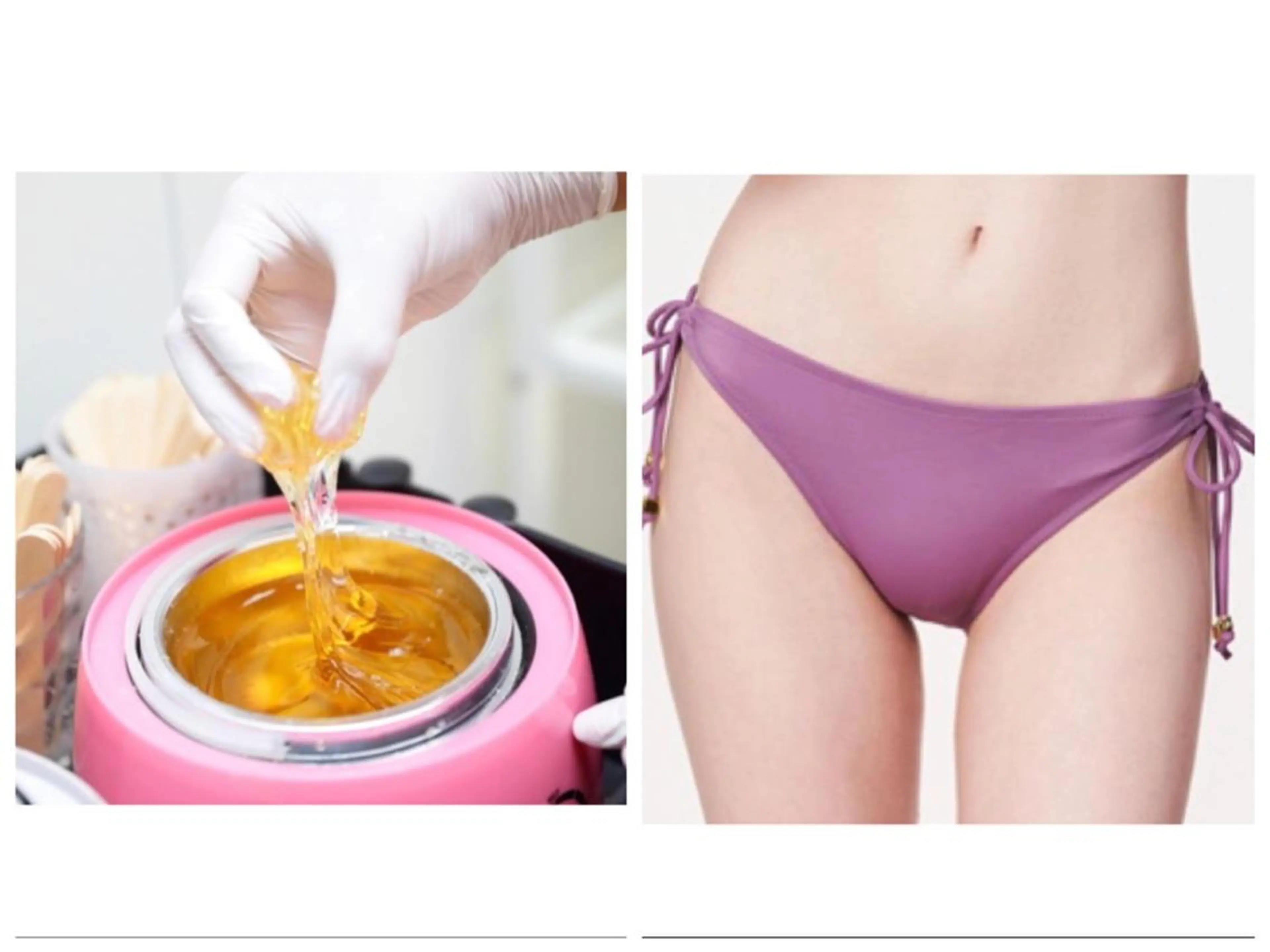 【女性限定】施術直後からツルツル【VIOシュガーリングワックス脱毛】＋潤い保湿仕上げの写真