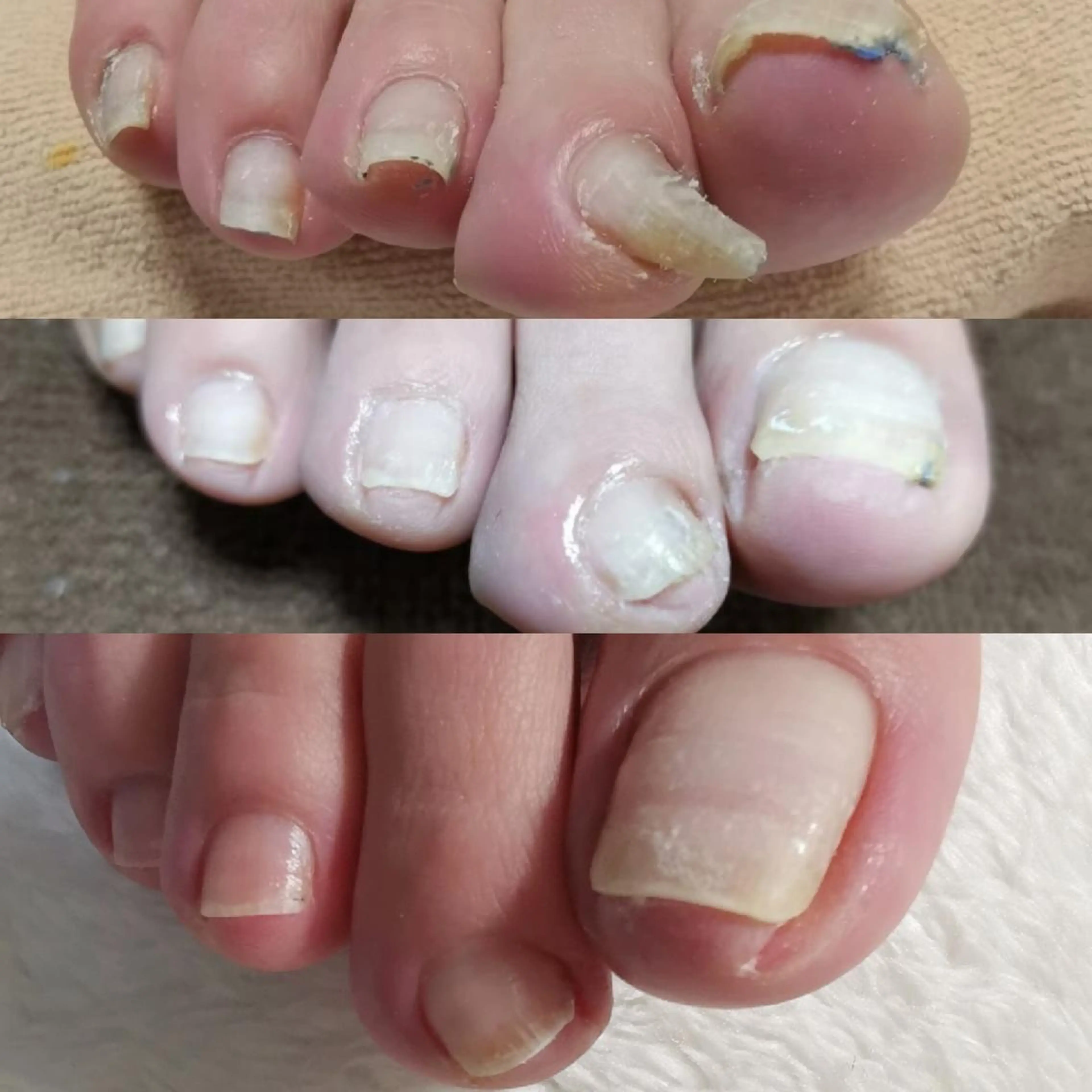 ネイル フットネイル reve あやののネイルデザイン