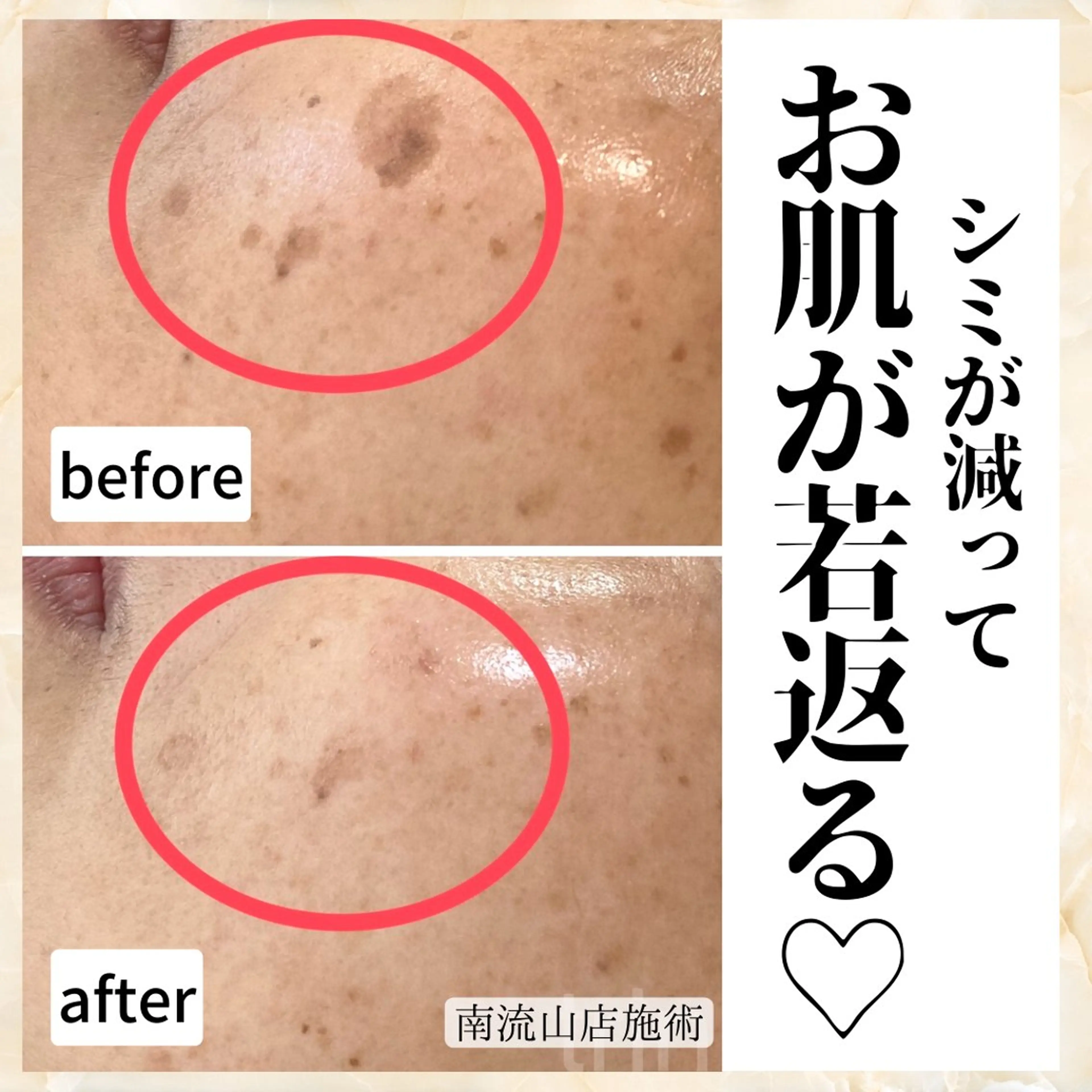 シミケア肌改善専門 トリニエンス新宿店のエステ・リラクイメージ