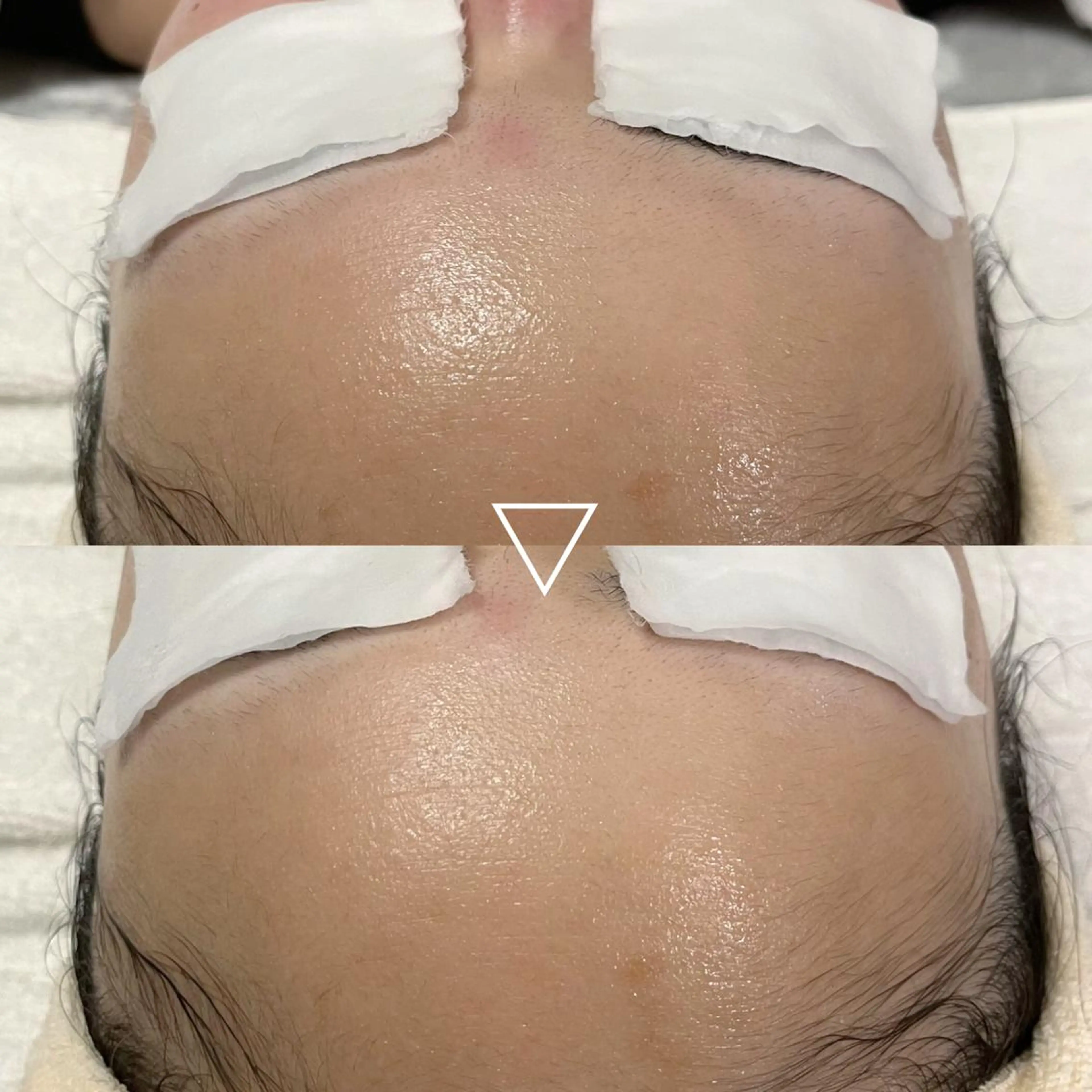 エステ 肌質改善＋小顔 🤍Kyrieのエステ・リラクイメージ