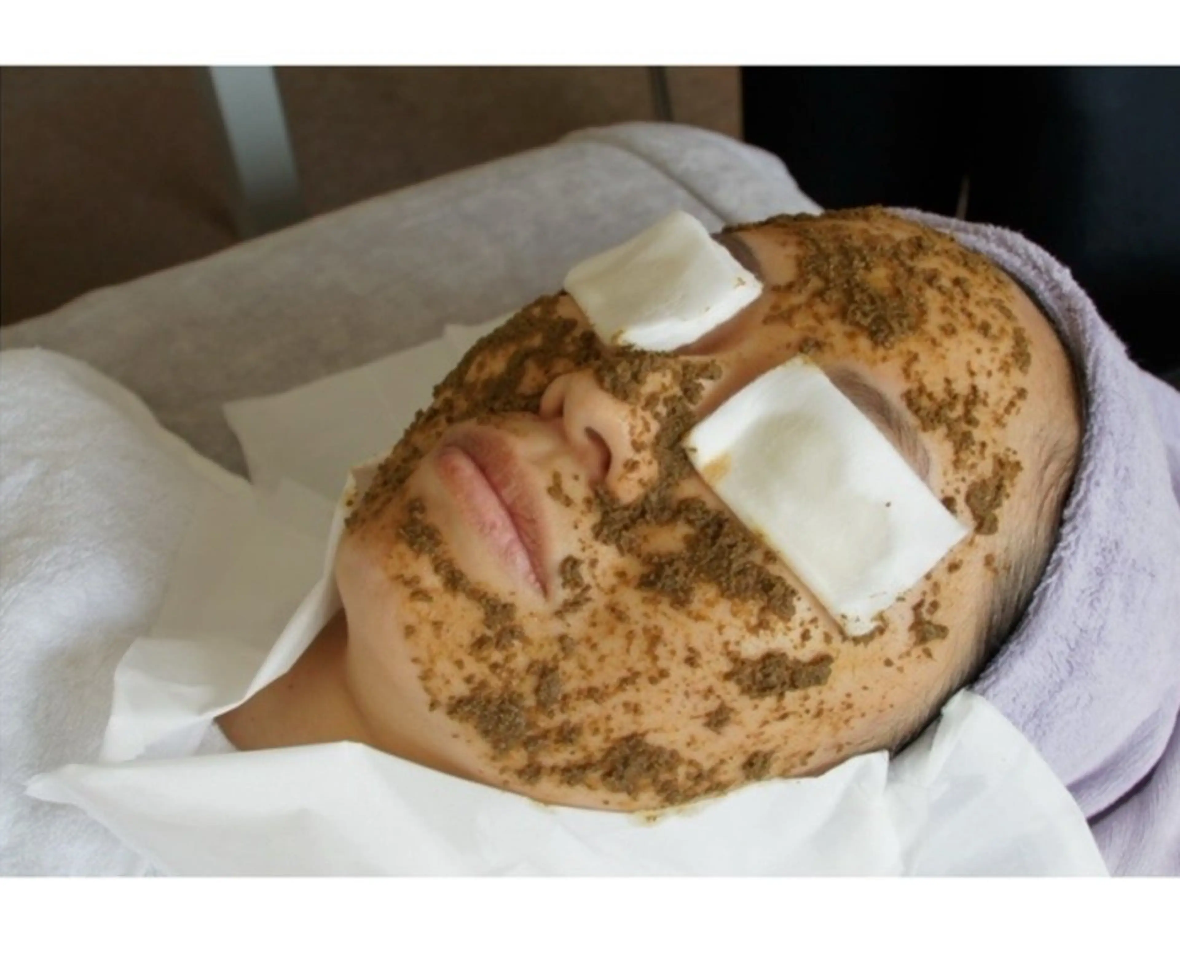 【ハーブピーリング】メンズにも人気！ツヤ肌質改善&ニキビ、毛穴ケア！美白クレイパック付き♪の写真