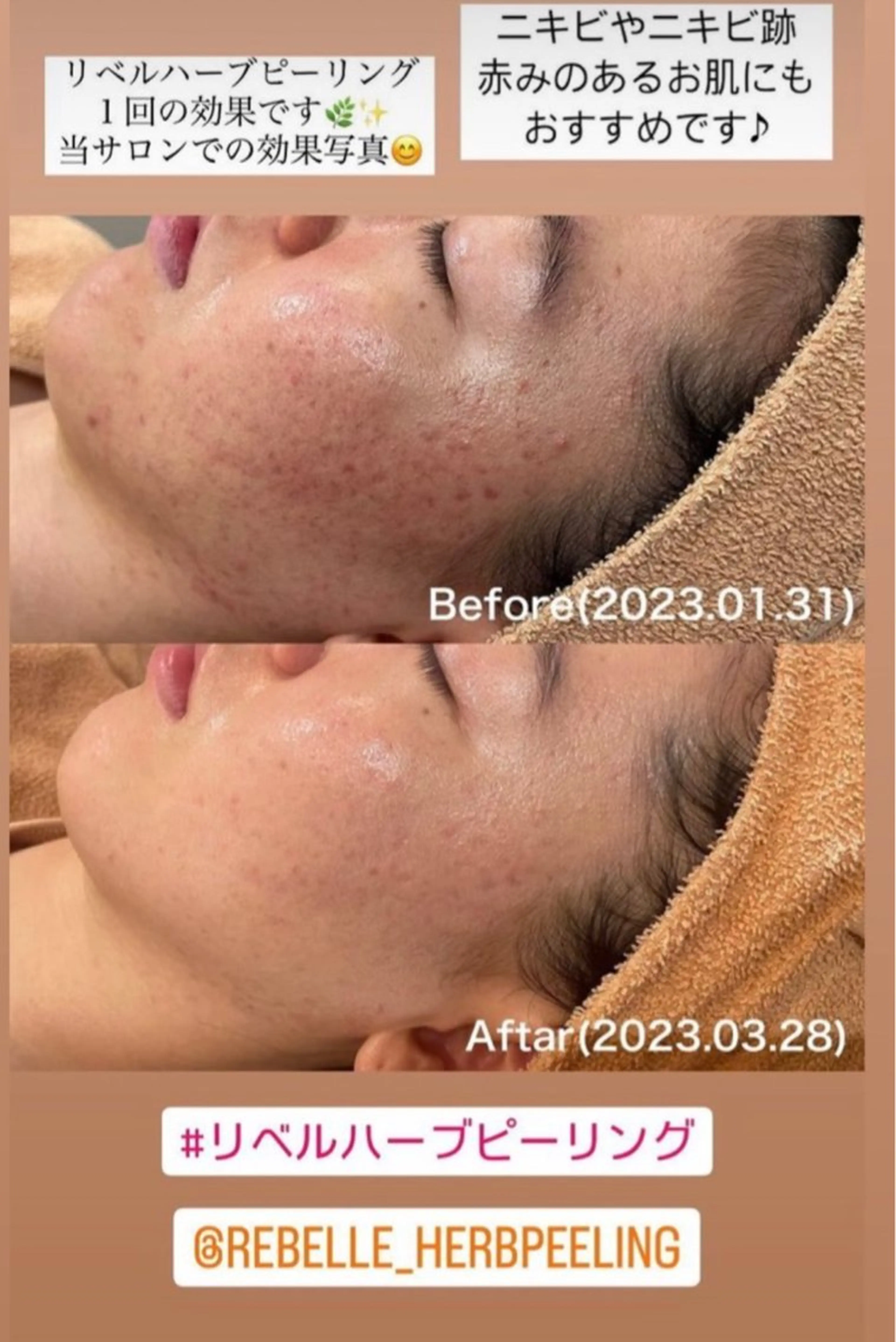 Liberte リベルテ(トモ化粧品店内)所属・Liberte’/ rinaのマツエク・マツパデザイン