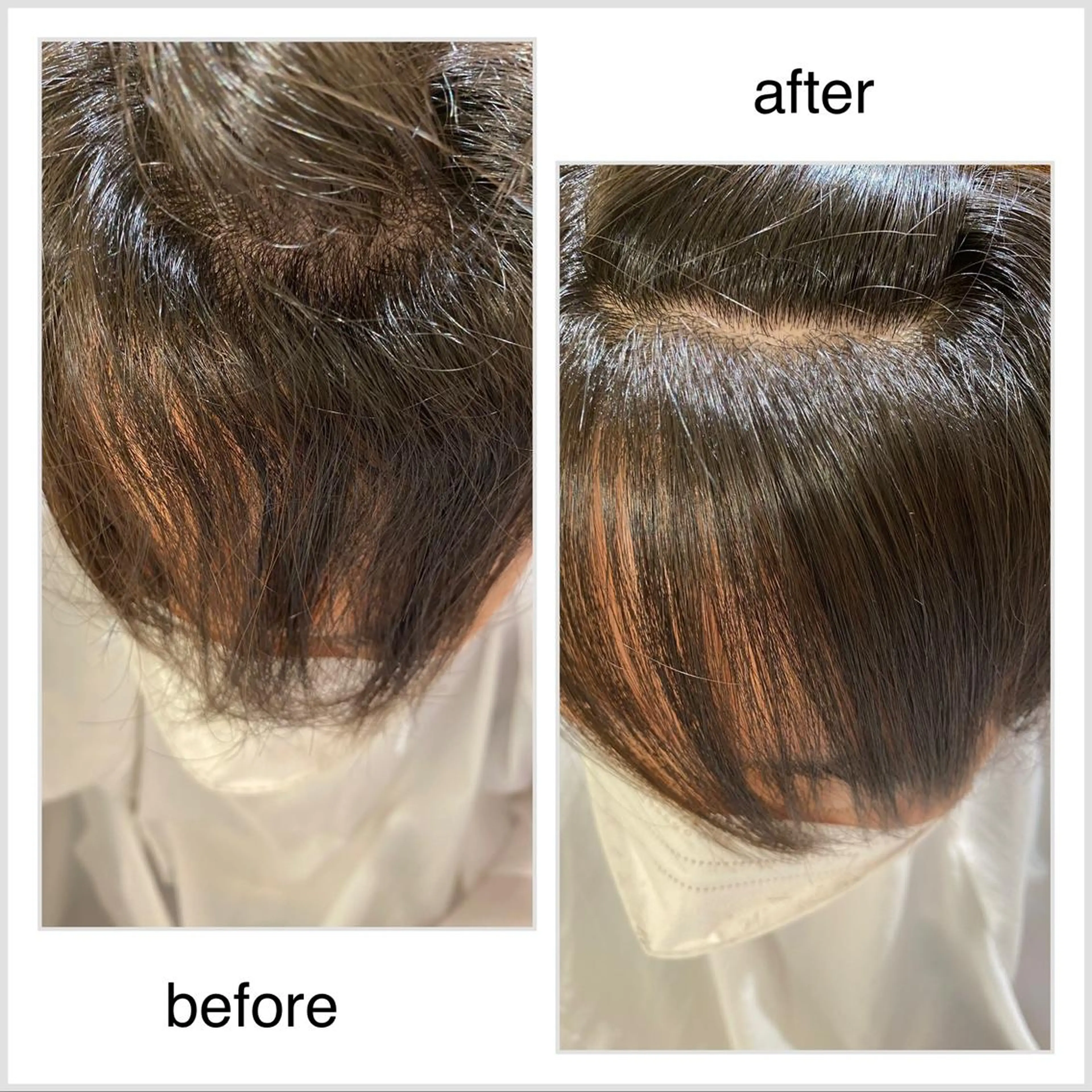 髪質改善美髪矯正(前髪)の写真