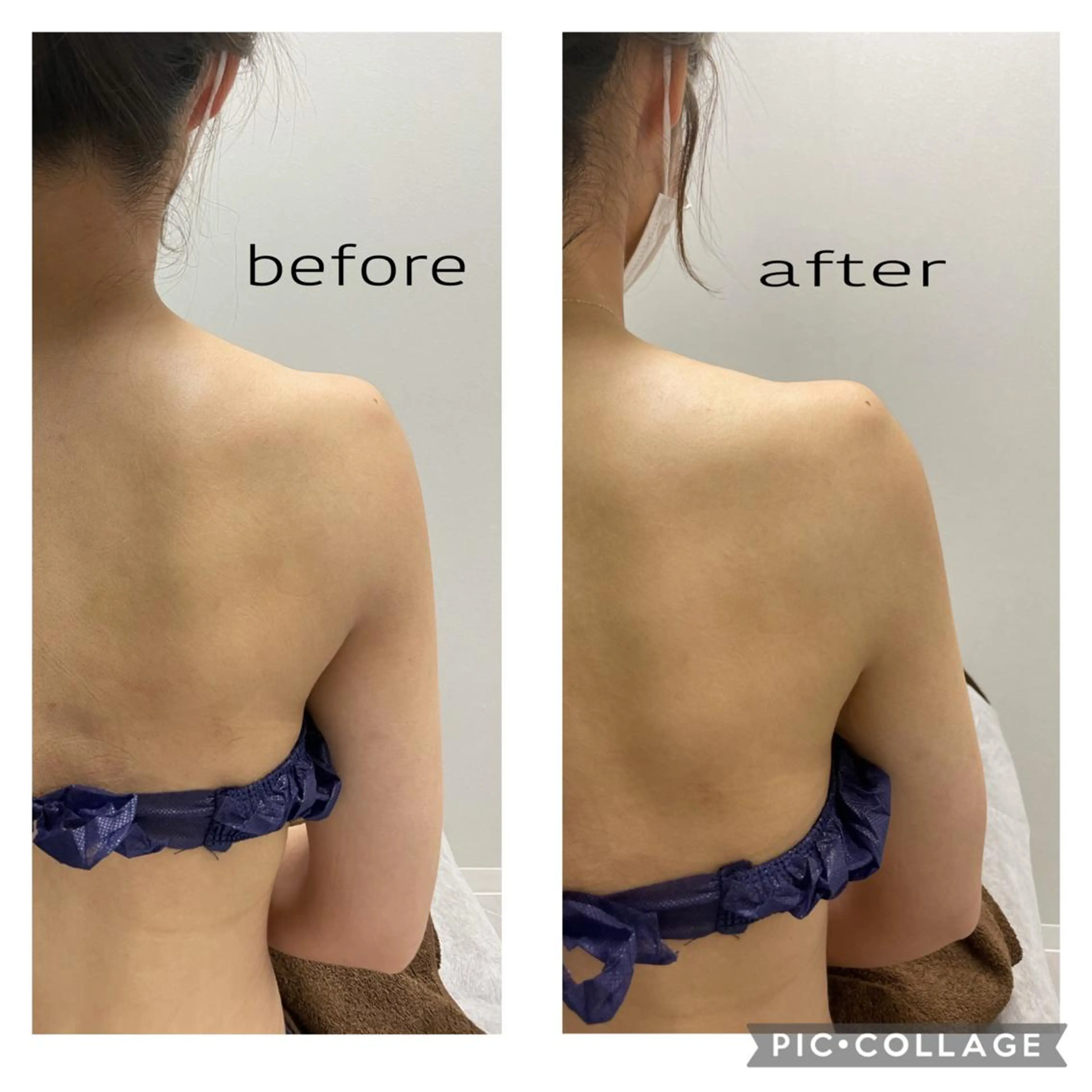 ENCHANT 脱毛.小顔.毛穴のエステ・リラクイメージ