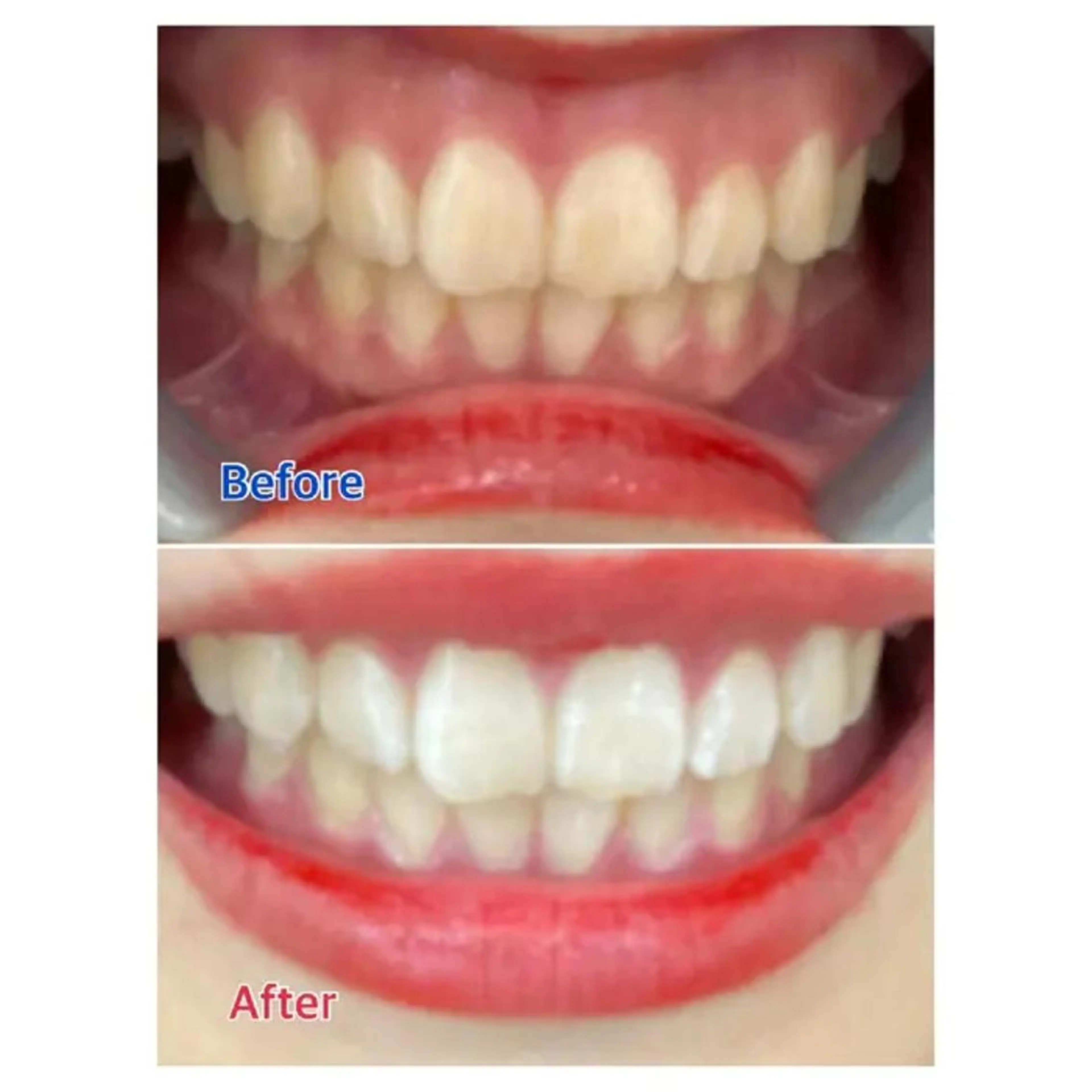 M渋谷 ホワイトニングのエステ・リラクイメージ