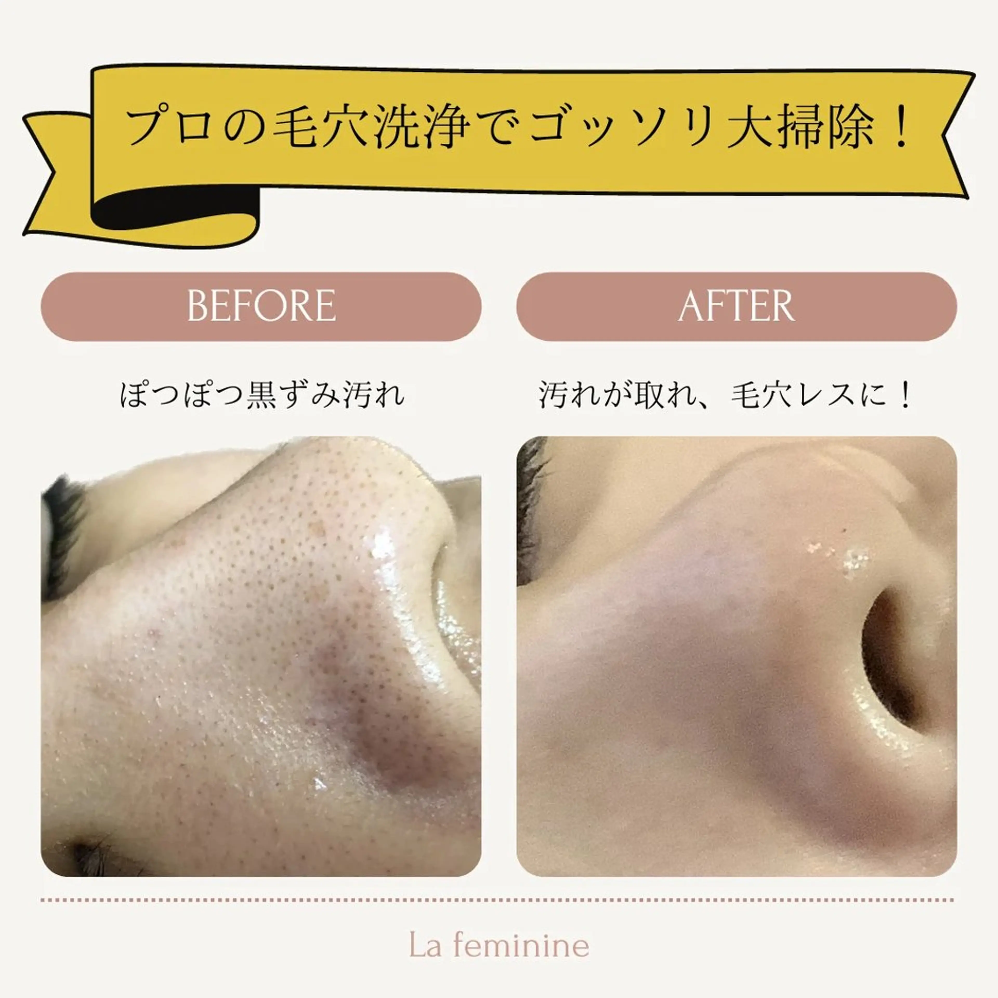 エステ リラク 【都度払い制】　脱毛 ・エステ　Linoのエステ・リラクイメージ