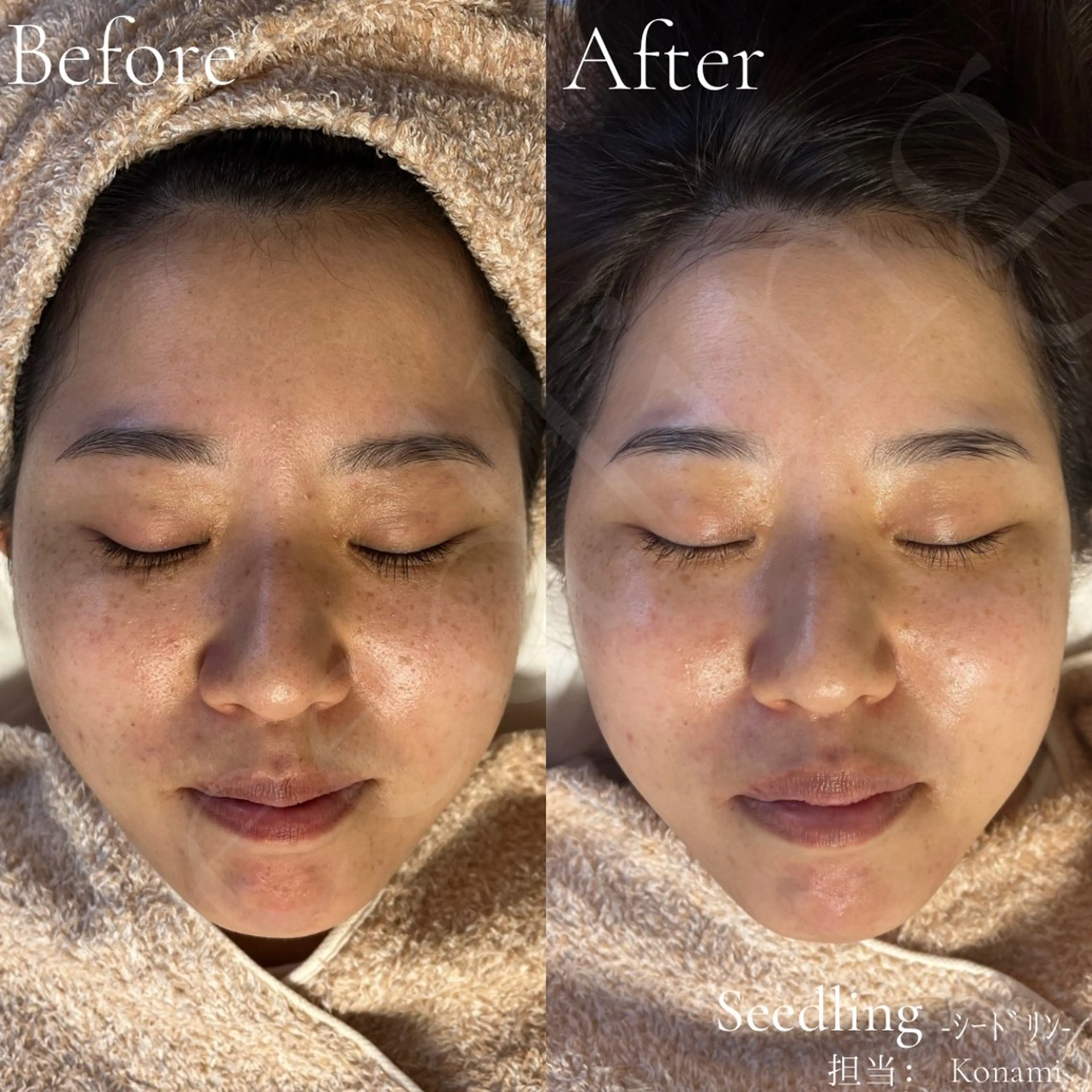 エステ シードリン 府内店 小波のヘアスタイル