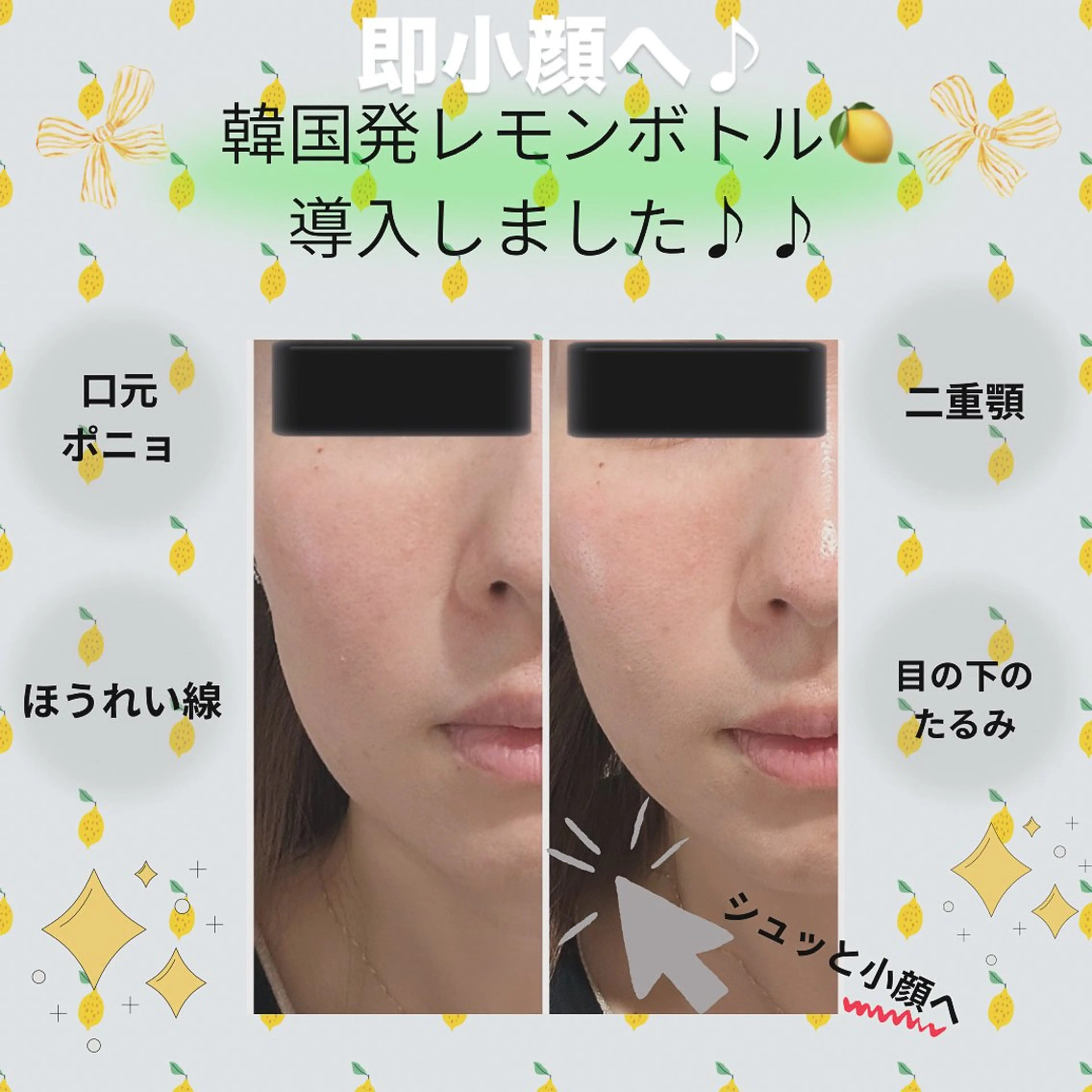 esthesalon Ran所属・小顔美肌痩身サロン Ranのその他イメージ