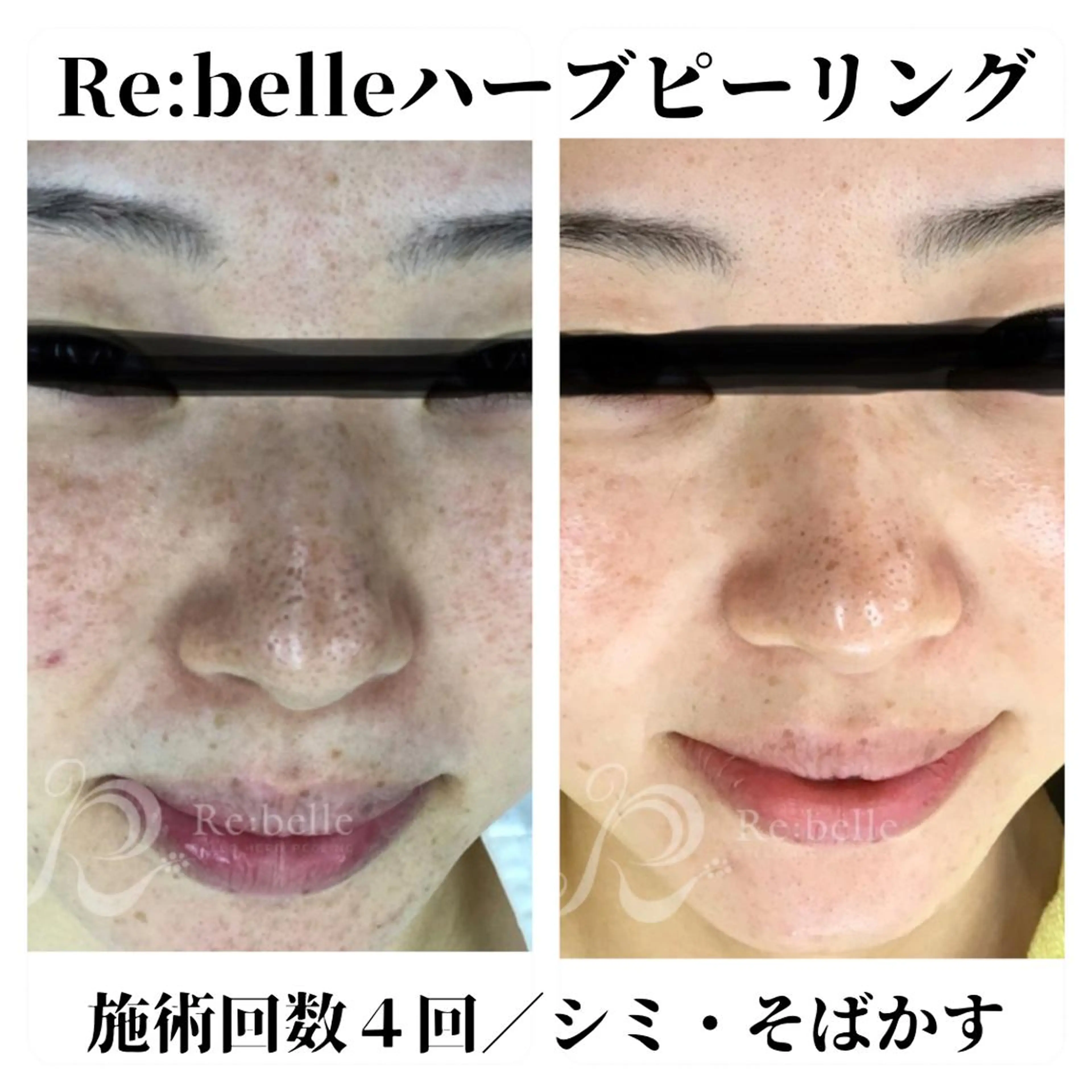 トータルビューティー サロンSalaのマツエク・マツパデザイン