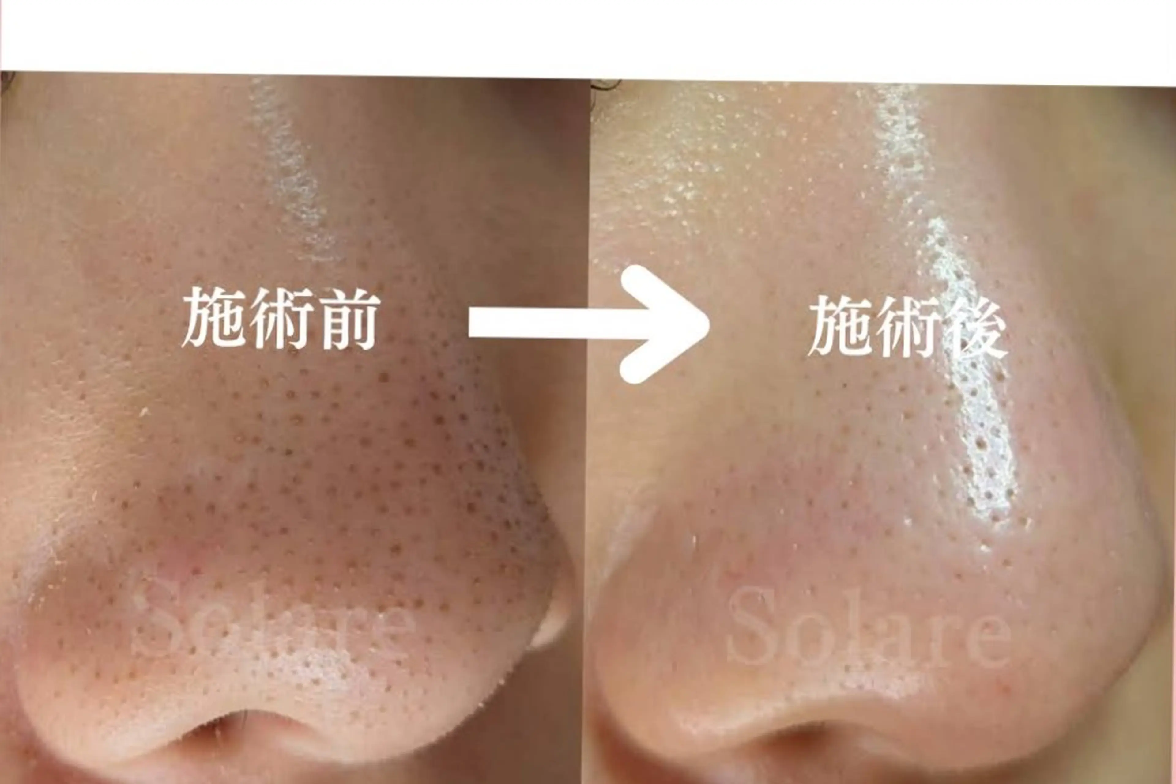 エステ リラク  毛穴洗浄・まつ毛 の専門店 ソラーレのエステ・リラクイメージ