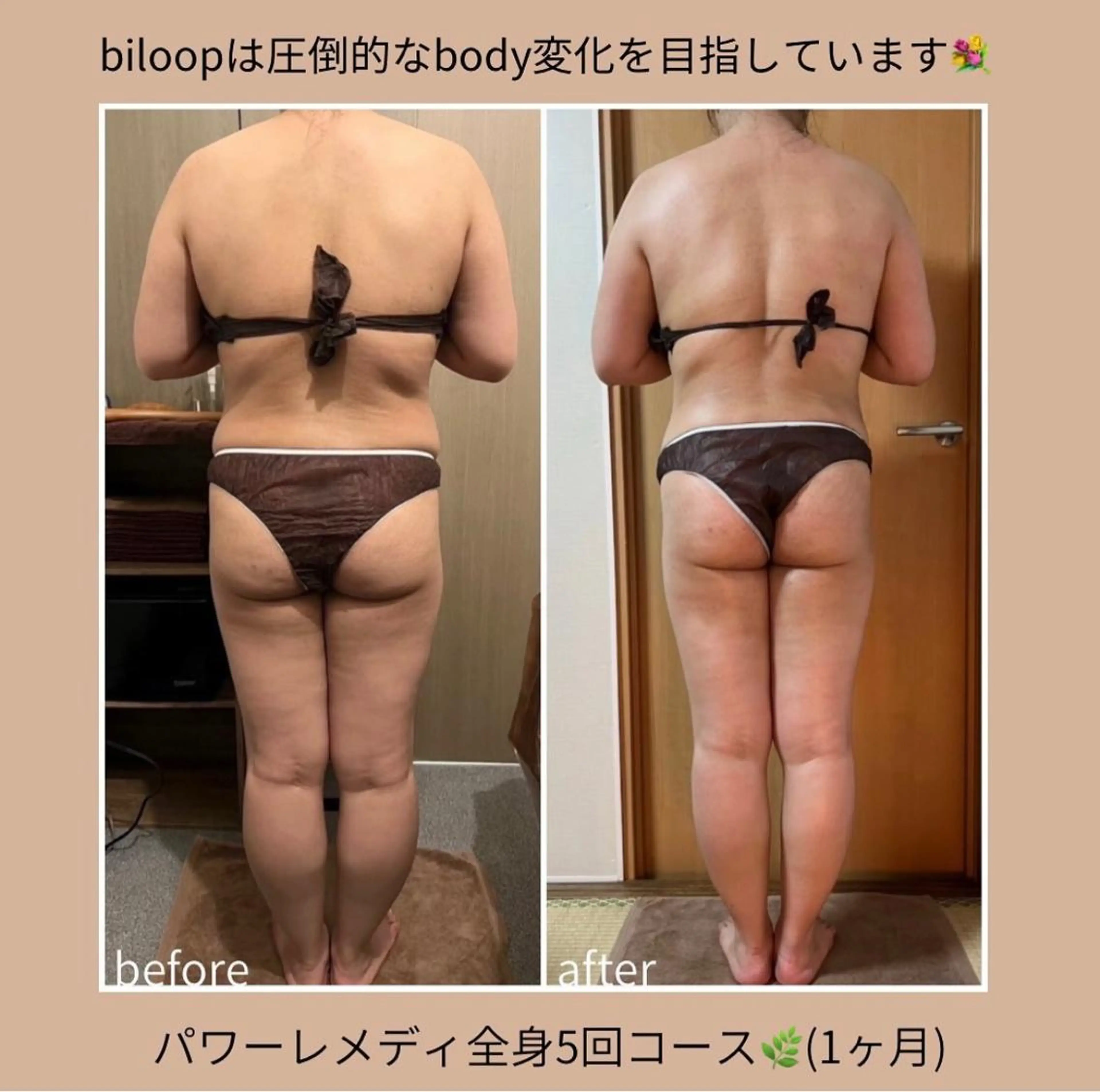 biloop所属・《本気痩せ×疲労改善 》  BILOOPのエステ・リラクイメージ