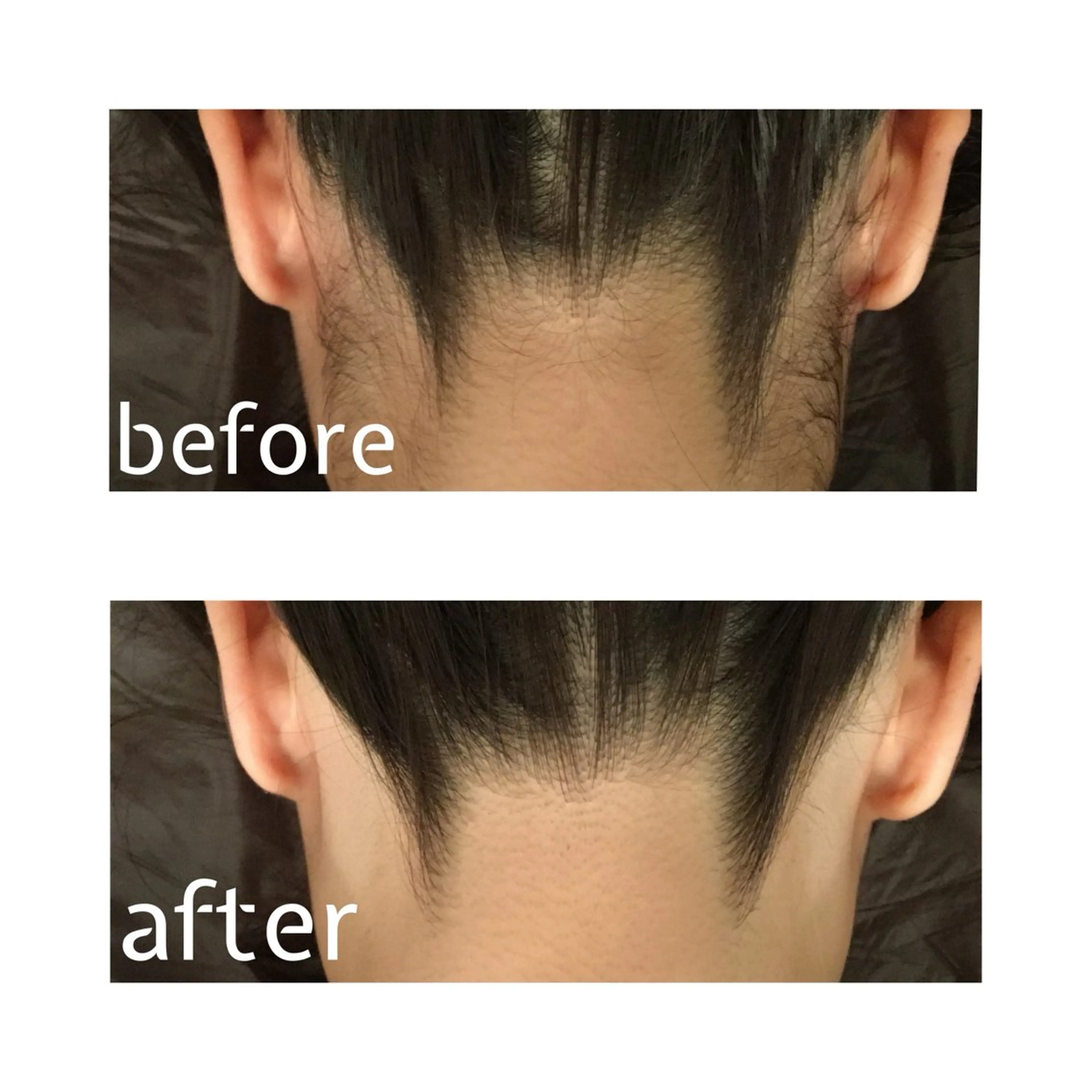 脱毛 トータルサロンRuby所属・【医療提携】脱毛 小顔ハーブピーリングのエステ・リラクイメージ