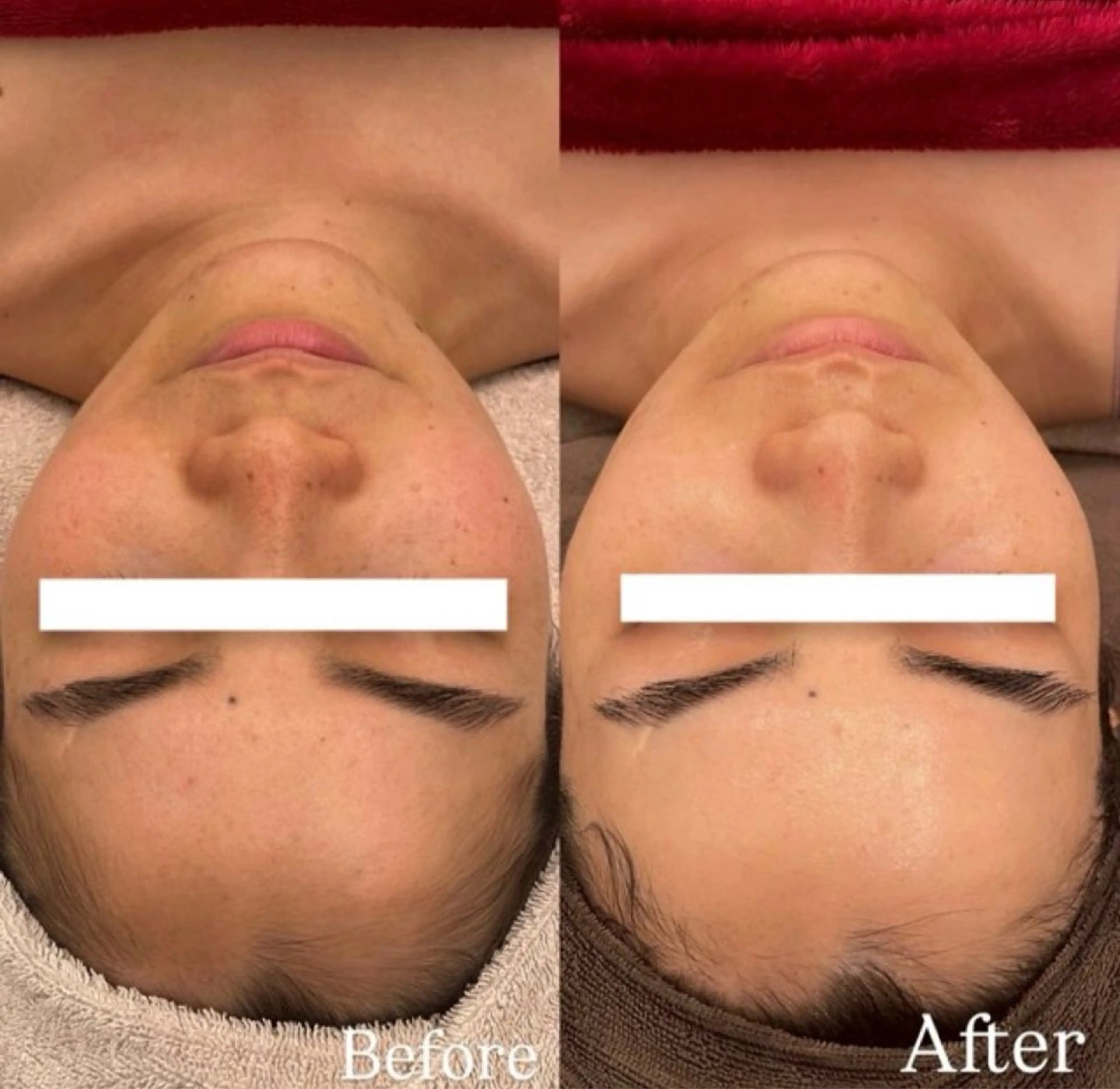 脱毛 Dioe 自由が丘のエステ・リラクイメージ