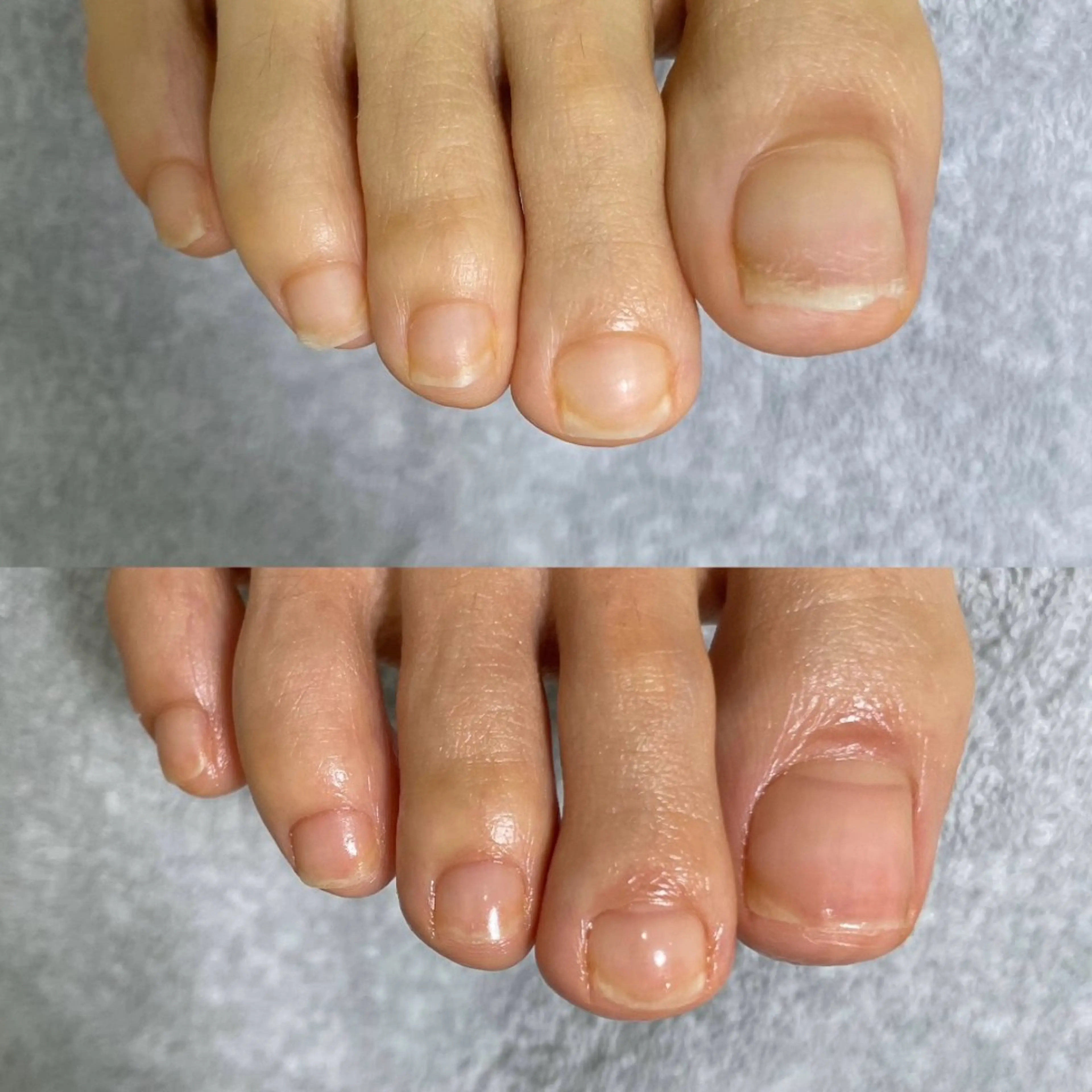 フットケアの写真