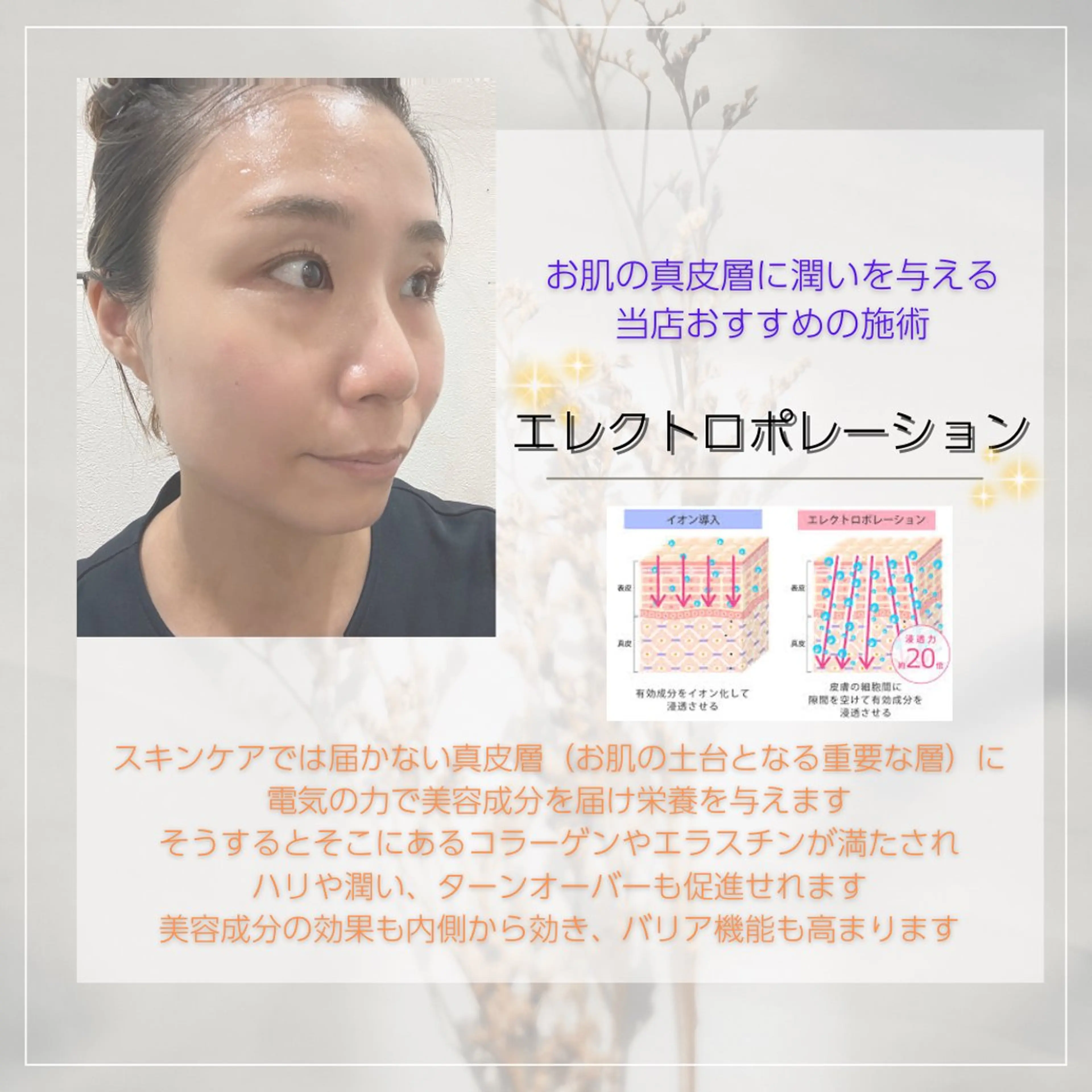 エステ vary  clue MISAのその他イメージ